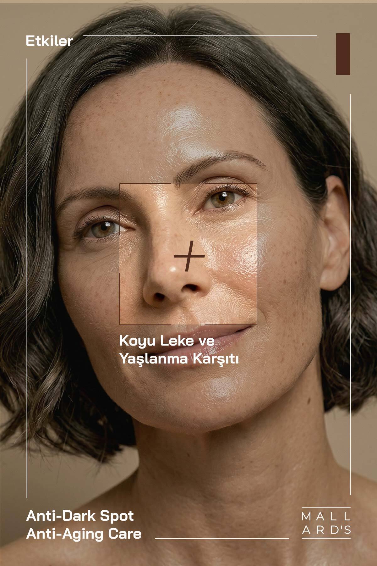 Kojic Acid & Tranexamic Acid, Leke Açıcı ve Ton Eşitleyici Serum, 50 ml — KAS30 — تصویر 2 از 8