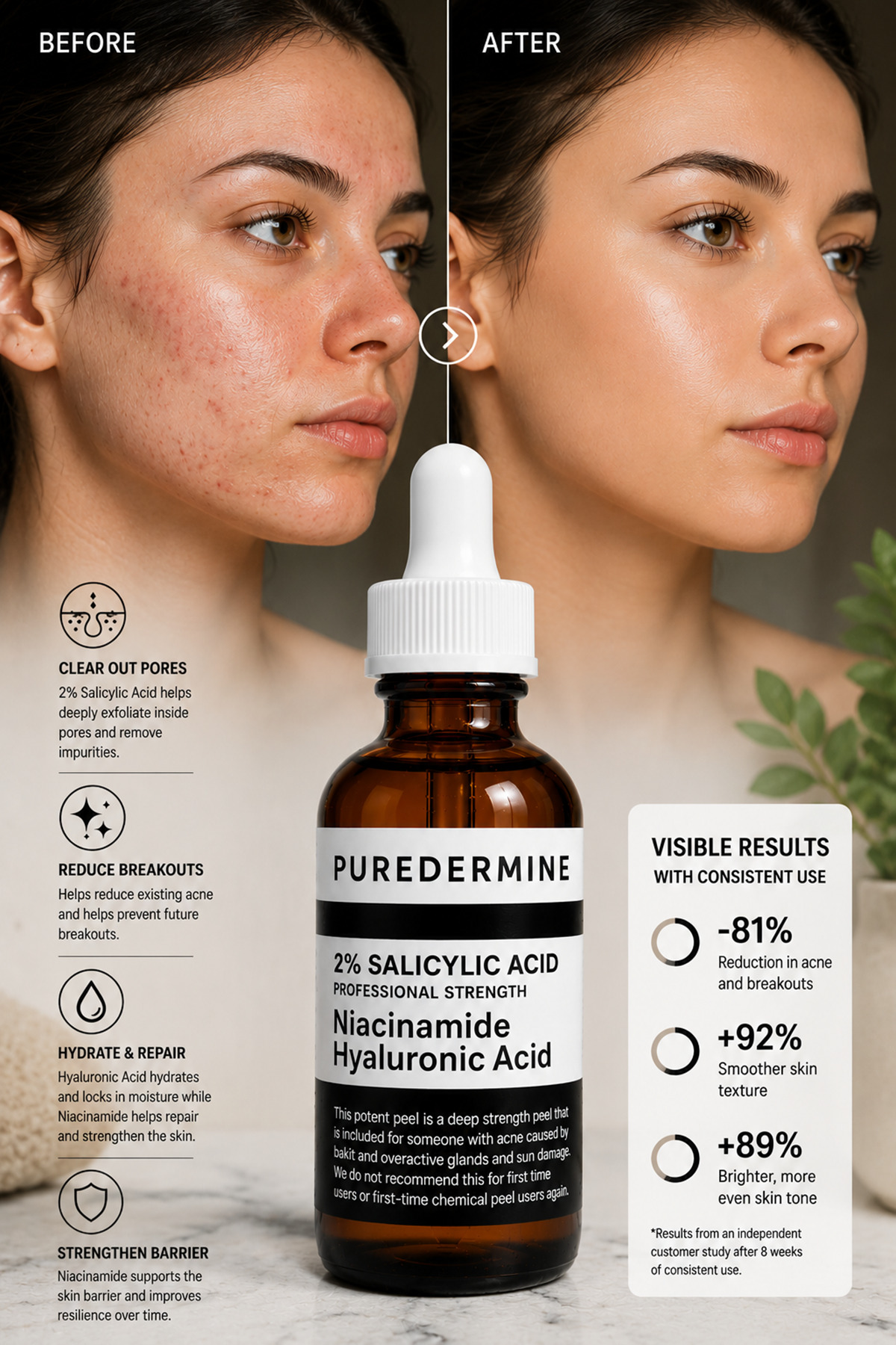 Salisilik Asit Serum %2 BHA İçerikli Niacinamide ve Hyaluronik Asit Destekli Siyah Nokta Karşıtı Yağlı ve Akneye Eğilimli Ciltler İçin Bakım Serumu — 35-2 — تصویر 5 از 8