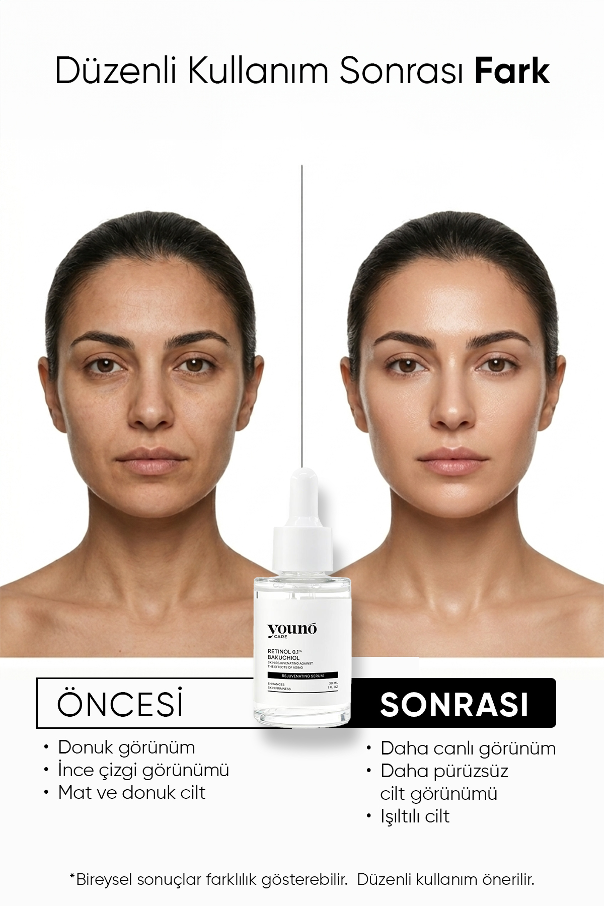 Bakuchiol Retinol Serum Yaşlanma Karşıtı 30 ml | Bakuchiol & Retinol | 3'lü Ceramide | Ginseng — YC-SKN-RJS-30 — تصویر 6 از 8