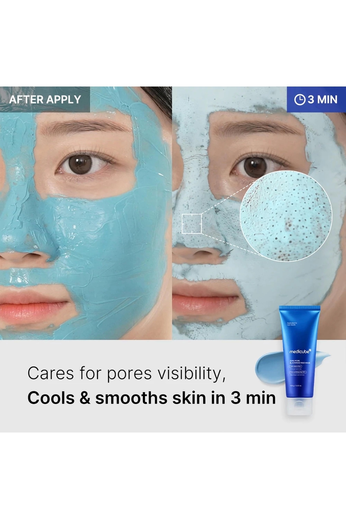 ZERO PORE BLACKHEAD MUD MASK ( Sıfır Gözenek Siyah Nokta Kil Maskesi) (GLOBALCARE) — KRNDY1320 — تصویر 3 از 4