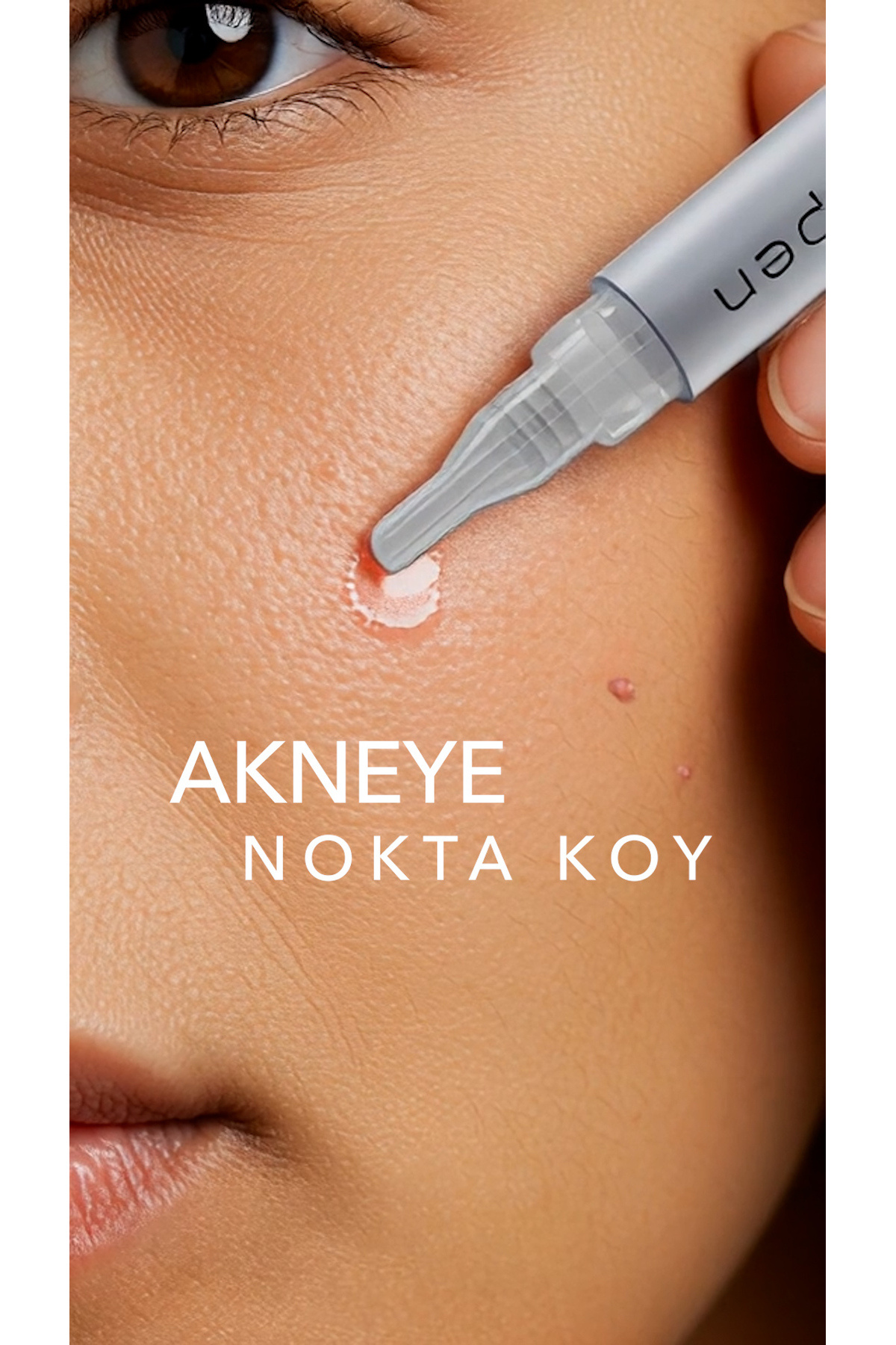 Acnepen Karşıtı Solüsyon - Akne Karşıtı Serum — E010203AC01 — تصویر 5 از 9