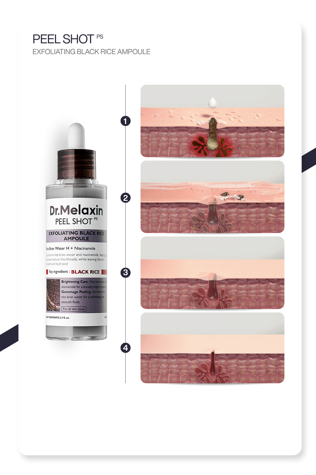 Siyah Pirinç Özlü | Gözenek & Siyah Nokta Karşıtı | Arındırıcı Peeling Serum 80ml — 8809886482373 — تصویر 3 از 7
