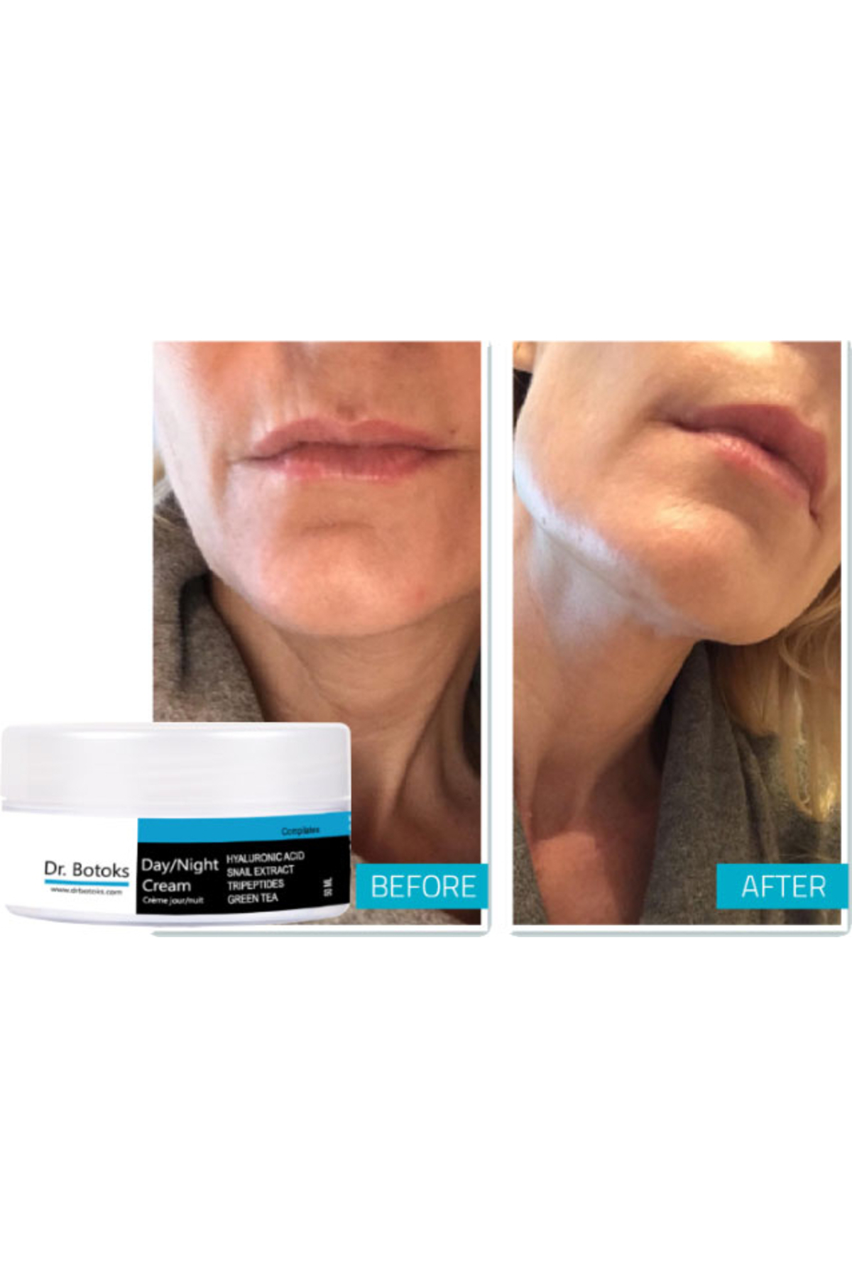Dr. Botoks Cream 2 Adet Bakım Kremi 50 ml — GU-EYF-15537-NIDA01 — تصویر 2 از 3