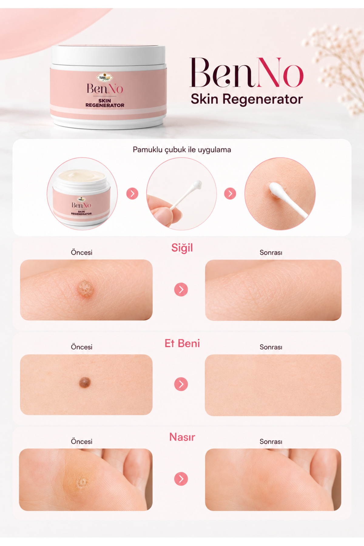 BenNO Skin Regenerator 25 ml Bölgesel Kozmetik Bakım Kremi - Cilt Yenileme Kremi — Benno1 — تصویر 3 از 7