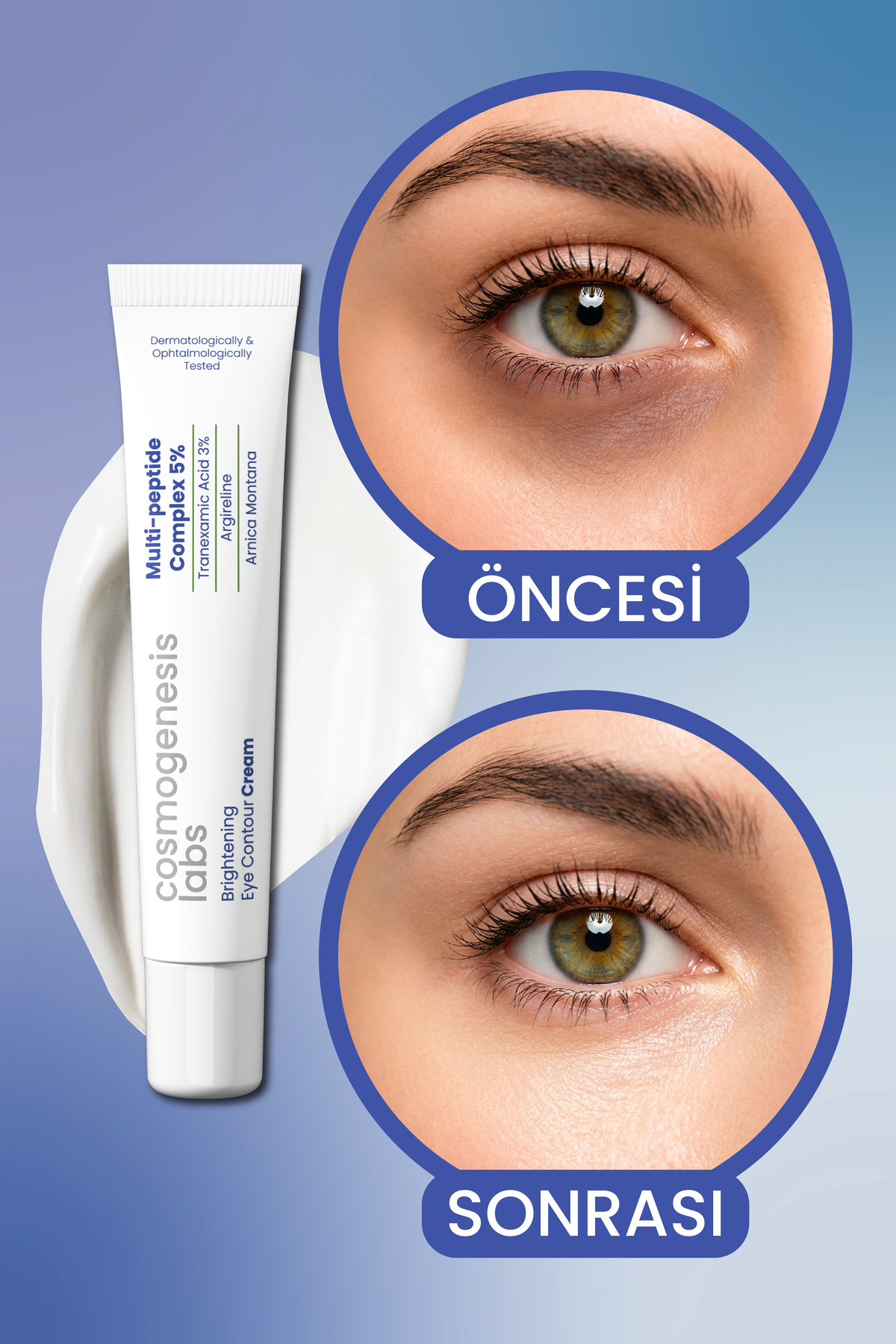 Göz Altı Aydınlatıcı Krem 20ml - Koyu Halka Ve Şişlik Karşıtı Nemlendirici Vegan (Tranexamc Acid) — CGL197A — تصویر 4 از 7