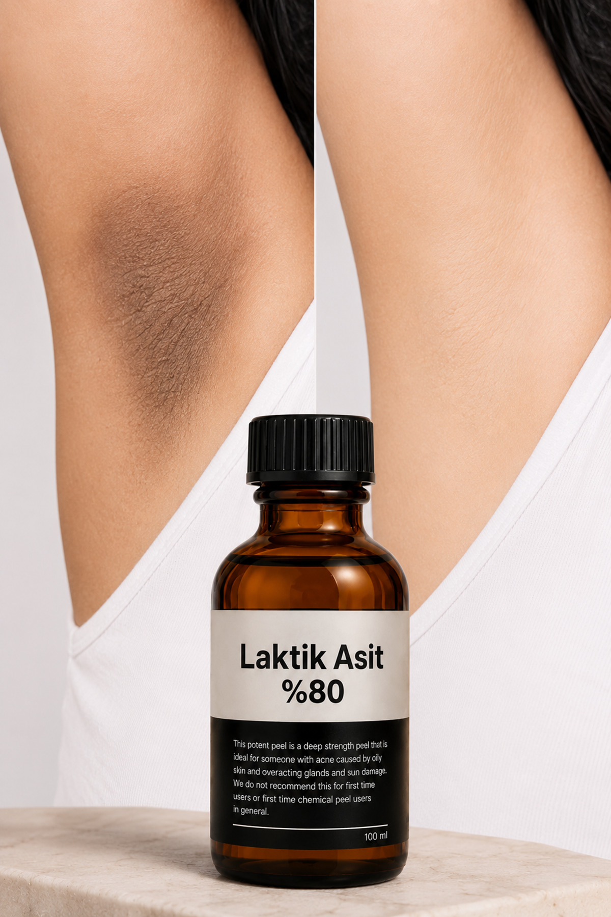 لایه برداری حرفه ای ۸۰٪ اسید لاکتیک برای تیرگی و تغییر رنگ در ناحیه بیکینی، زانوها، آرنج، زیر بغل، پشت و پاها — blue12 — تصویر 6 از 8