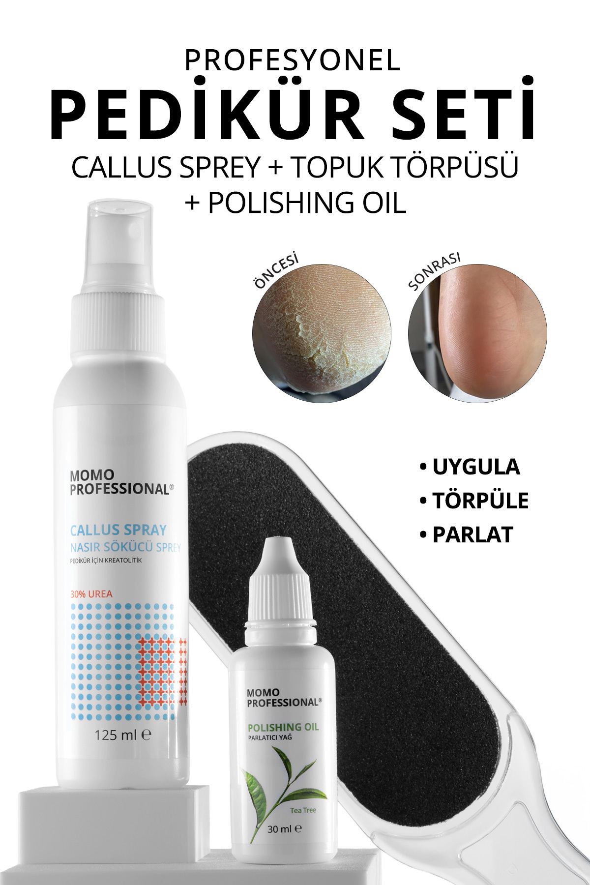 MOMO professional Profesyonel Pedikür İçin 3’lü Set, Nasır Sökücü Sprey 125 ml, Topuk Törpüsü 100/180 Grid, Parlatıcı — Bundle6