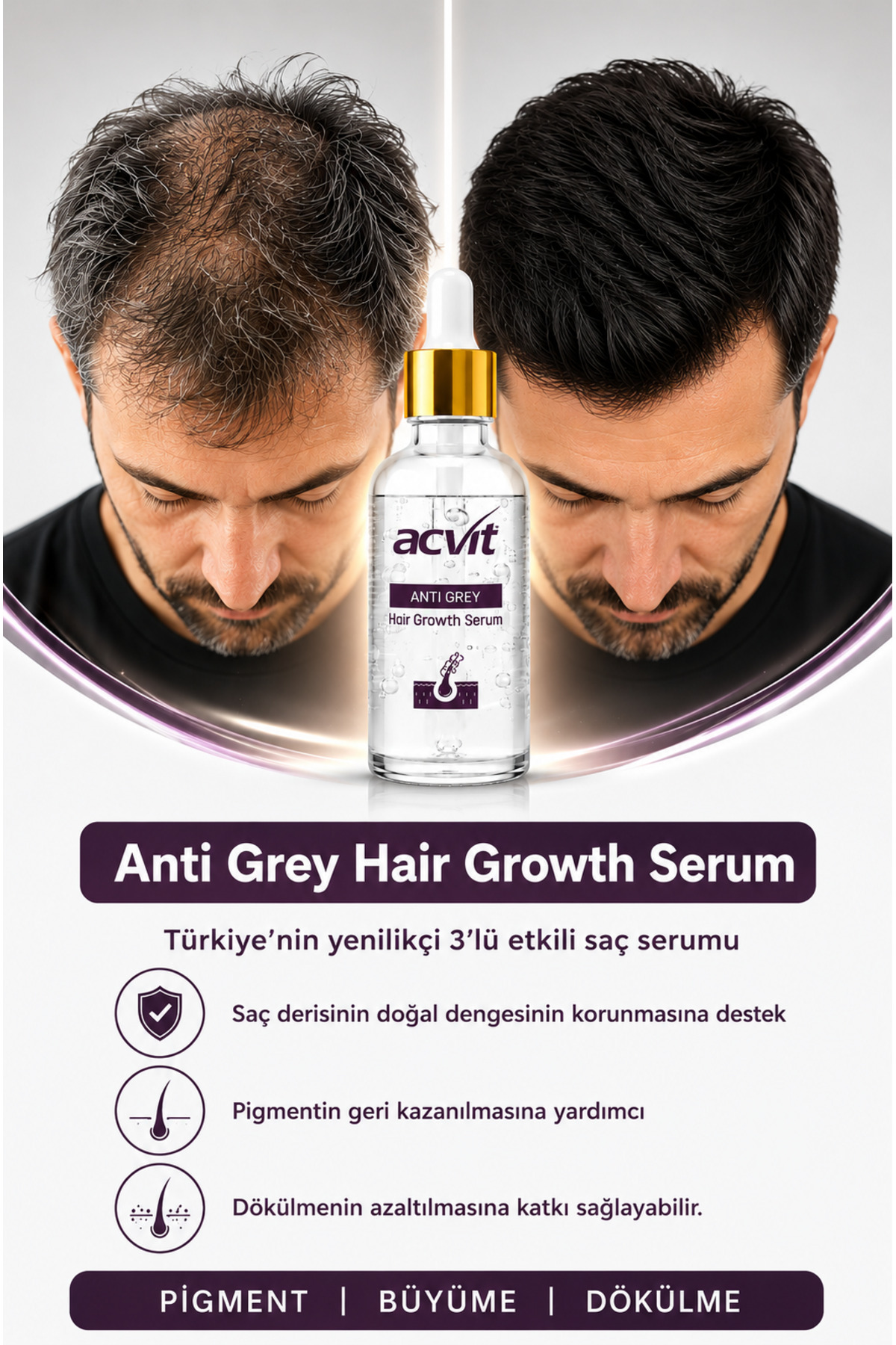 Anti Grey Hair Growth Serum - Beyaz Saç ve Dökülme Kontrolü - Saç Derisini Güçlendirme — AGH01 — تصویر 4 از 9