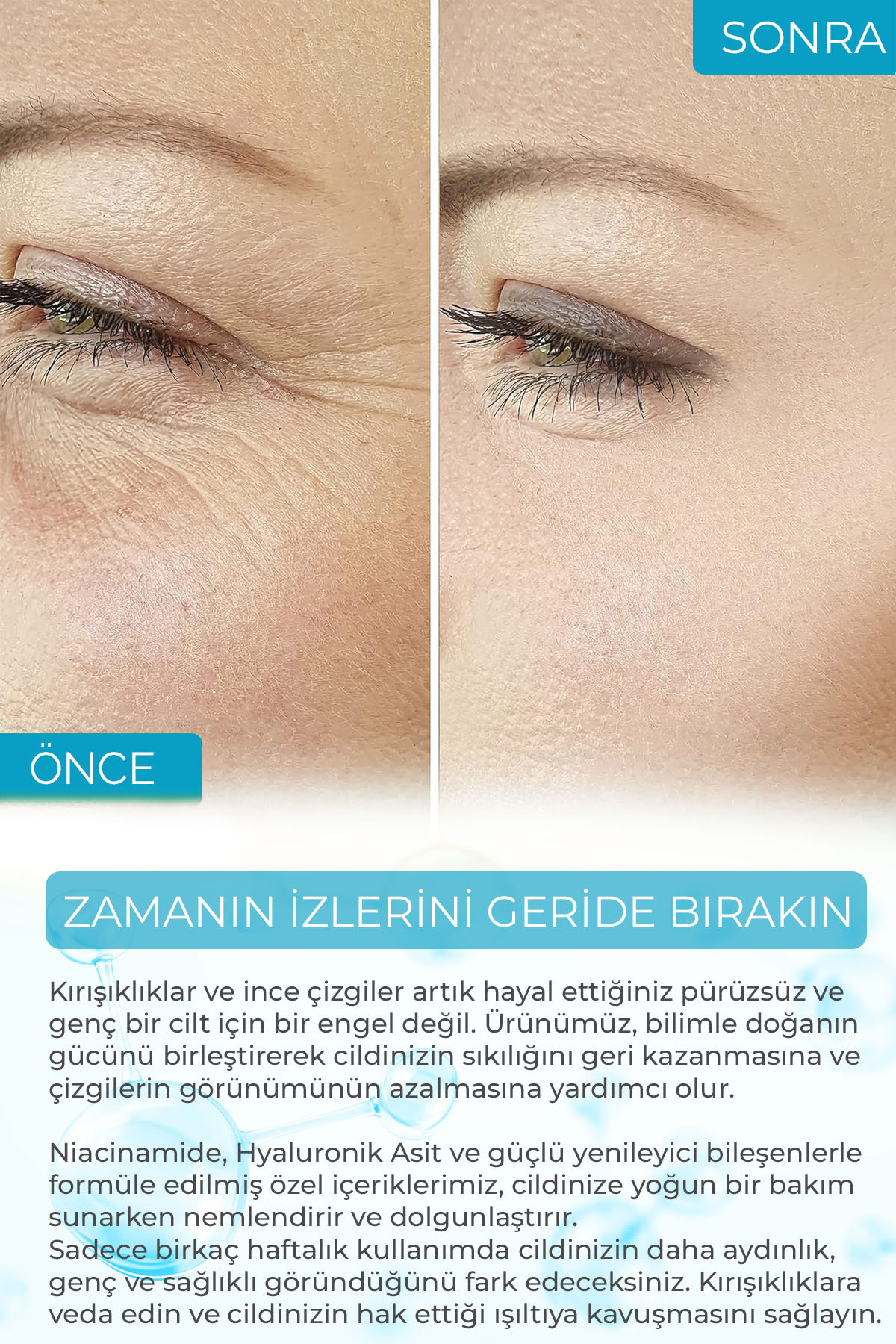 Nemlendirici Aydınlatıcı Hyaluronique Premium Serum Aura Series A250 — DA2501-A25 — تصویر 4 از 6