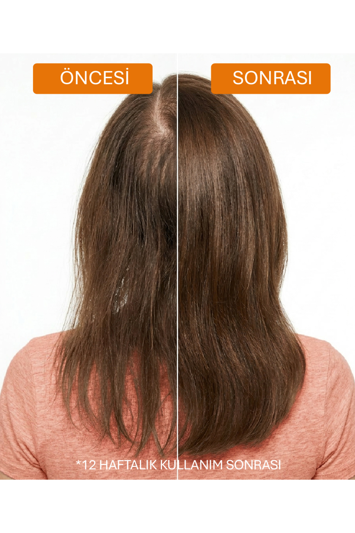 Dökülme Karşıtı Keratin Ve Kafein Içeren Sülfatsız Güçlendirici Şampuan 400 ml X3 Set — AJ.10.00039 — تصویر 7 از 8