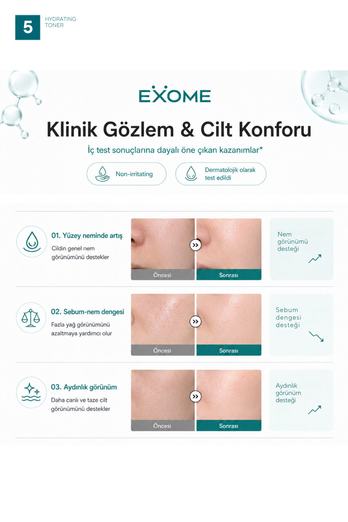 Nemlendirici Yüz Toniği | Panthenol & Hyaluronik Asit | Cilt Dengeleyici Bakım | Hydrating Toner | 150 ml — Exome005 — تصویر 6 از 6