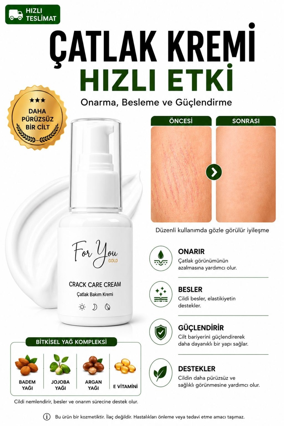 For You Gold Çatlak Önleyici Bakım Krem- Hamilelik & Doğum Sonrası Çatlak Bakım Kremi — çatkrem01