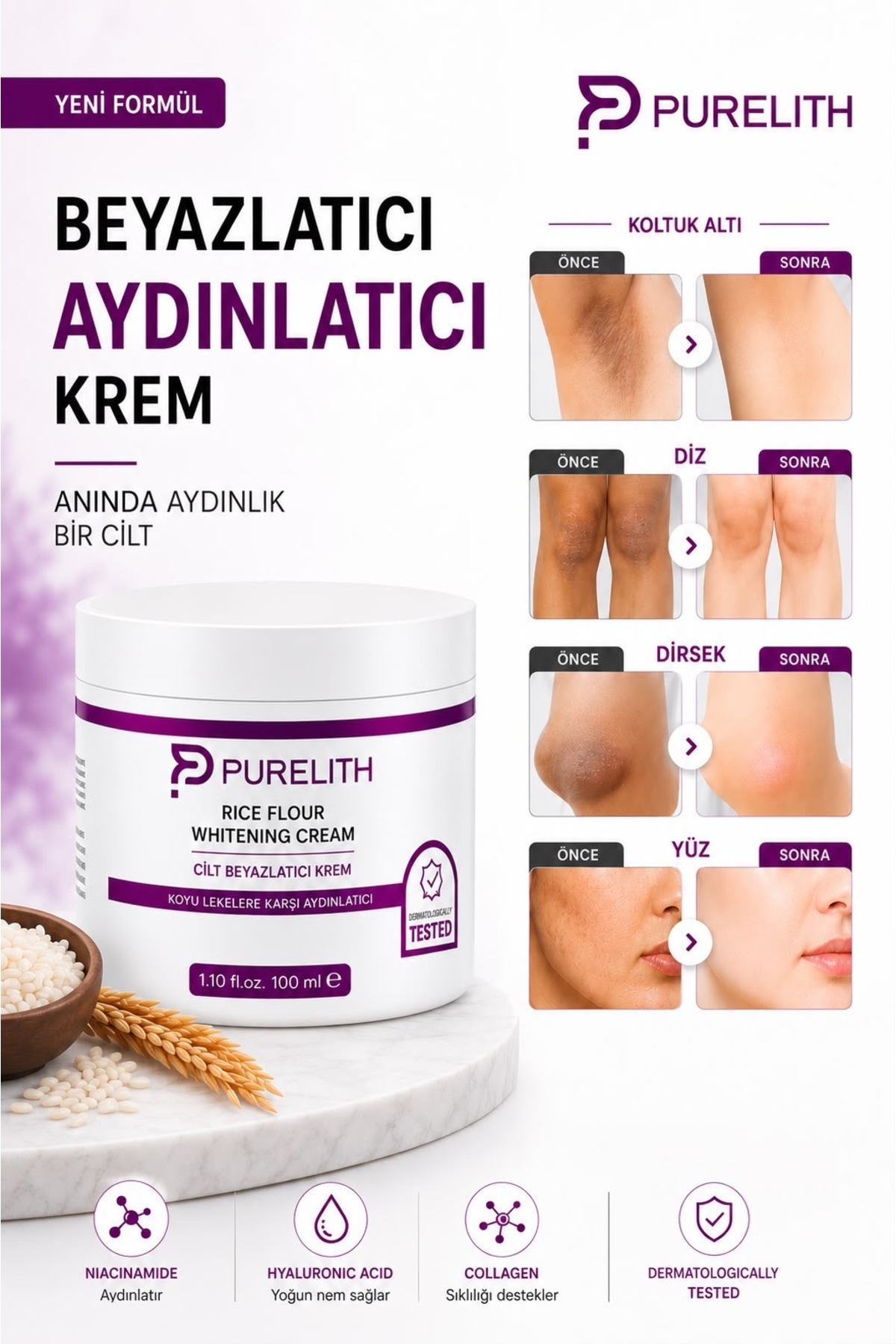 Cilt beyazlatici koltuk altı diz-dirsek ve cilt tonu eşitleyici ton eşitleyici 30+spf Beyazlatıcı Krem — beyazlatici,lekegiderici1,aydınlatıcı — تصویر 3 از 7