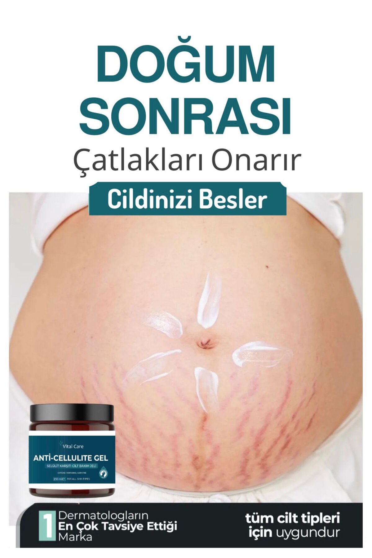 inceltici1 Sıkılaştırıcı, Selülit Ve Çatlak Giderici Vücut Şekillendirici Jel 250 ml — 3284923842 — تصویر 3 از 3