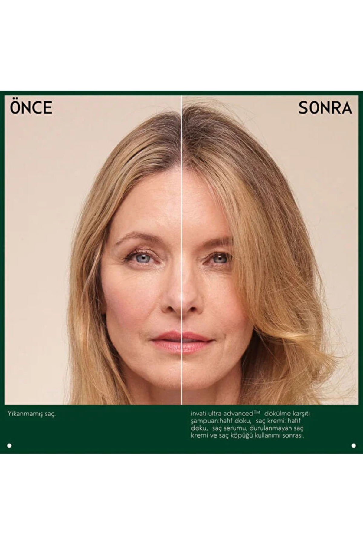 invati ultra advanced saç dolgunlaştırıcı köpük 45ml — TYCLW0NPLN172804537070012 — تصویر 2 از 7