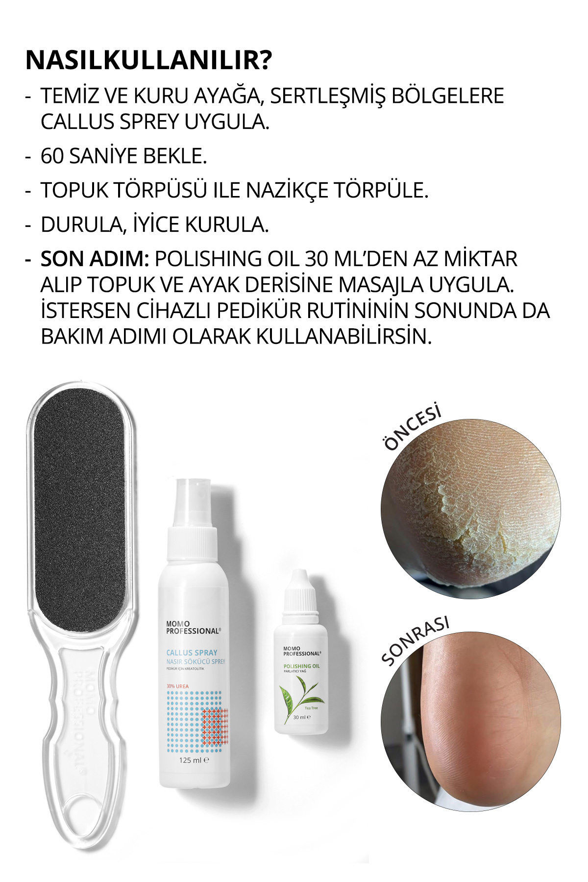 Profesyonel Pedikür İçin 3’lü Set, Nasır Sökücü Sprey 125 ml, Topuk Törpüsü 100/180 Grid, Parlatıcı — Bundle6 — تصویر 5 از 5