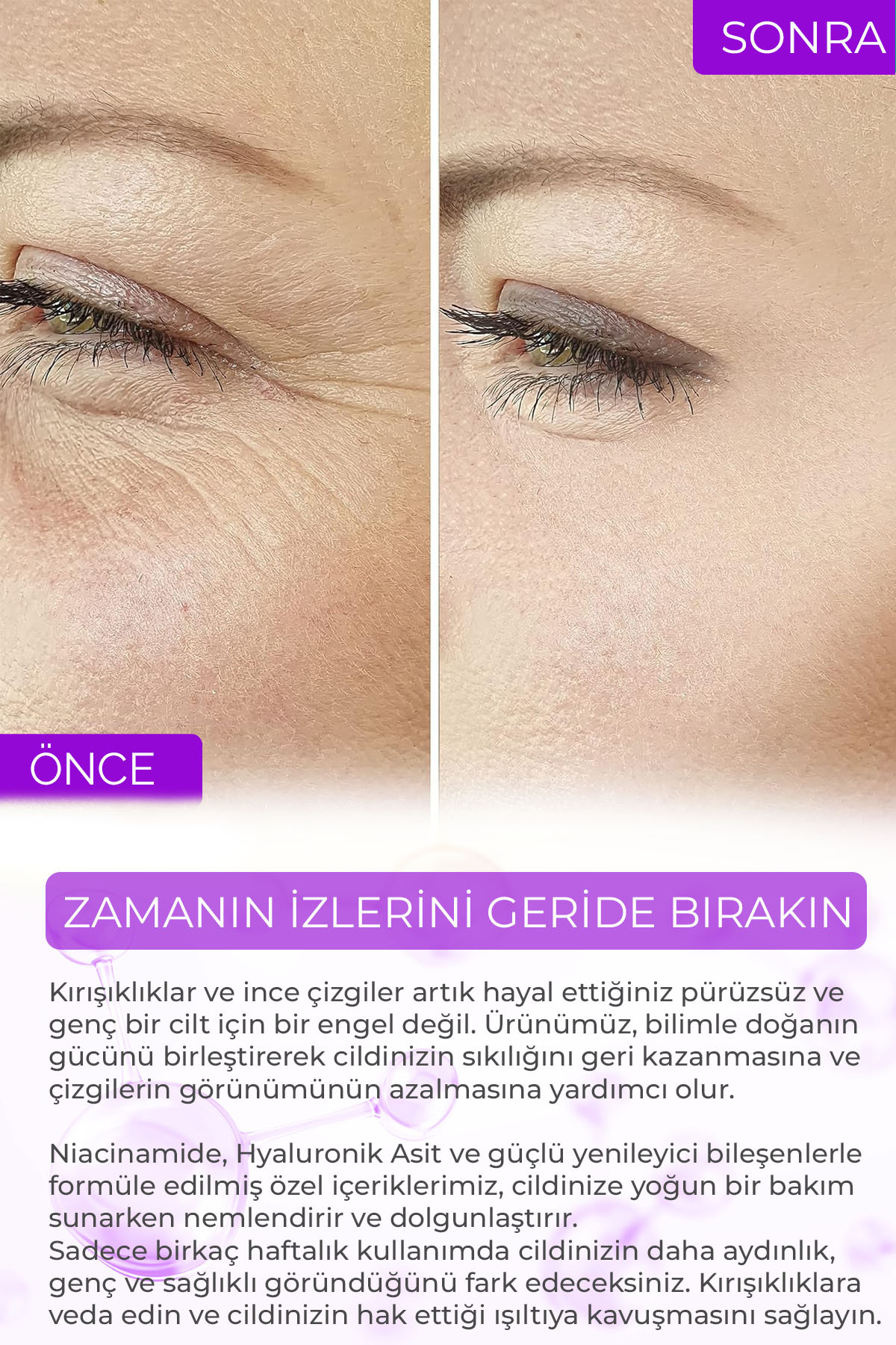 Retinol Göz Çevresi Alın Çizgisi Kırışıklık Karşıtı Serum Xella Series A220 — DA2501-A22 — تصویر 5 از 7