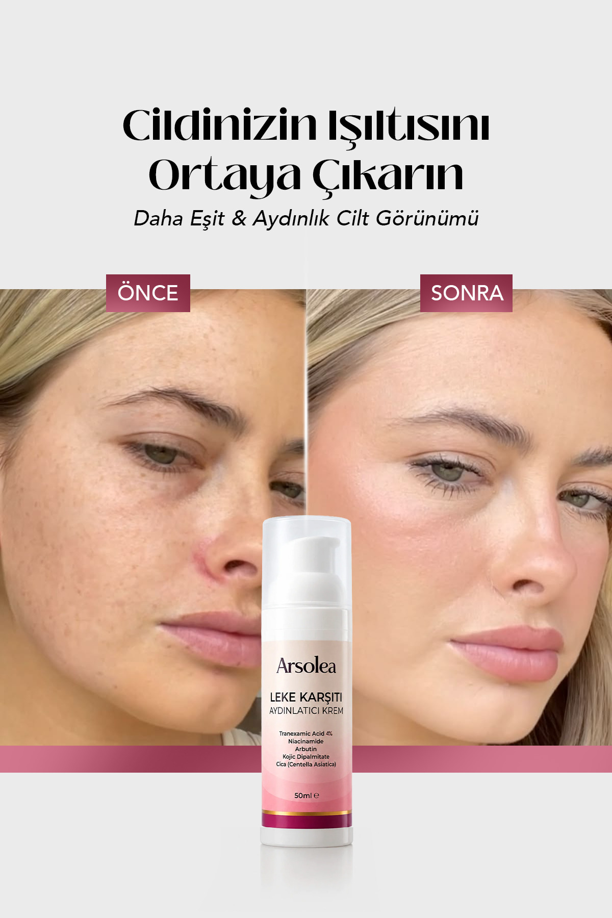 Leke Bakım Kremi %4 Tranexamic Acid Arbutin Kojic Dipalmitate 50 ml Cilt Tonu Eşitleyici Bakım — lekekrem — تصویر 3 از 7