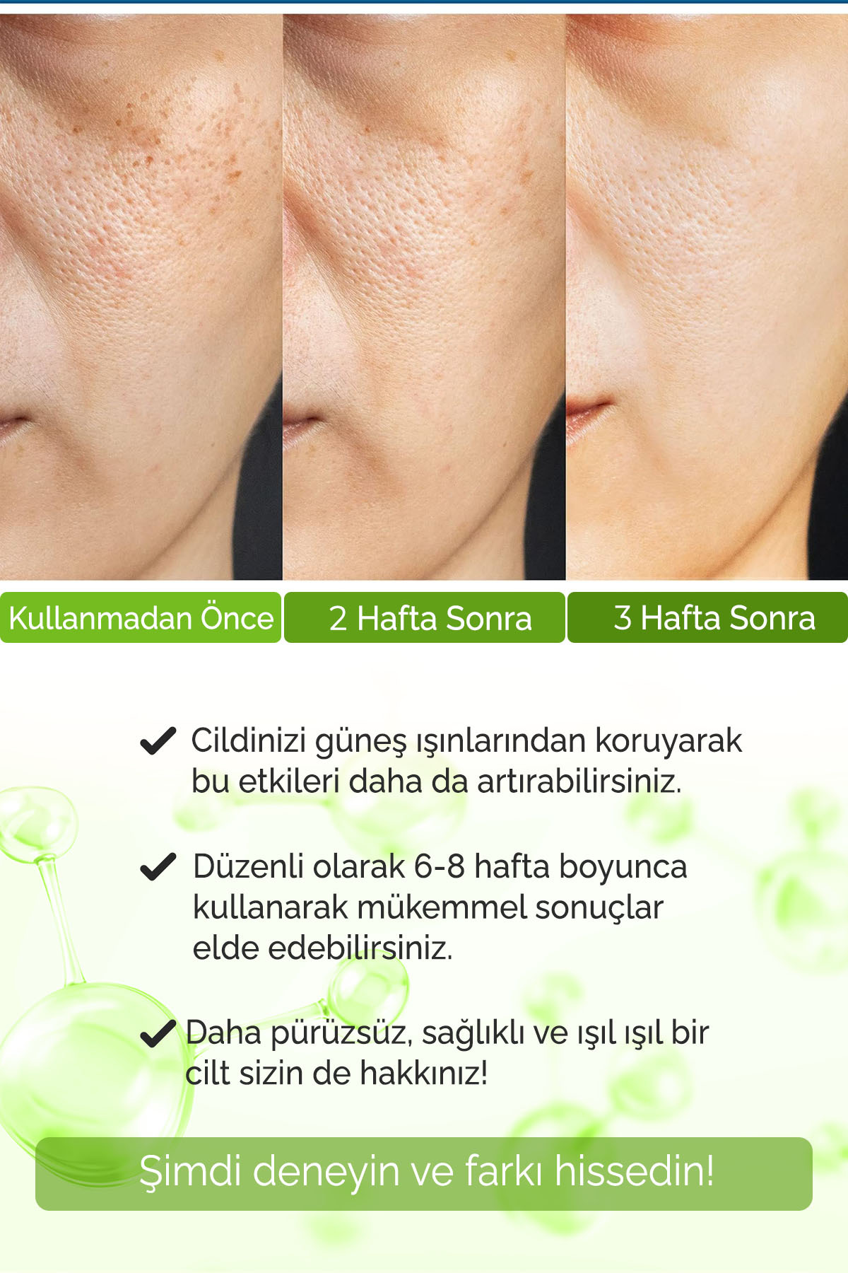 Gözenek Sıkılaştırıcı, Siyah Nokta ve Leke Karşıtı Serum Vivo Series A210 — DA2501-A21 — تصویر 4 از 6