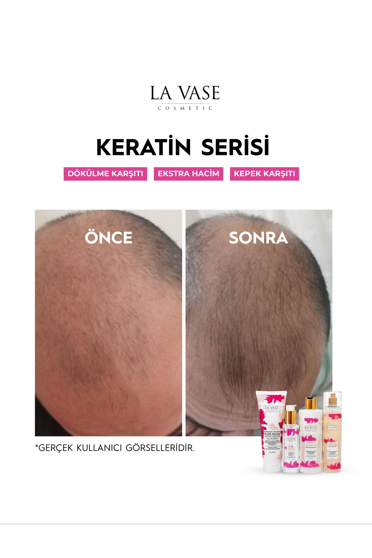 Keratin Saç Spreyi — La Vase Keratin Saç Spreyi — تصویر 4 از 6