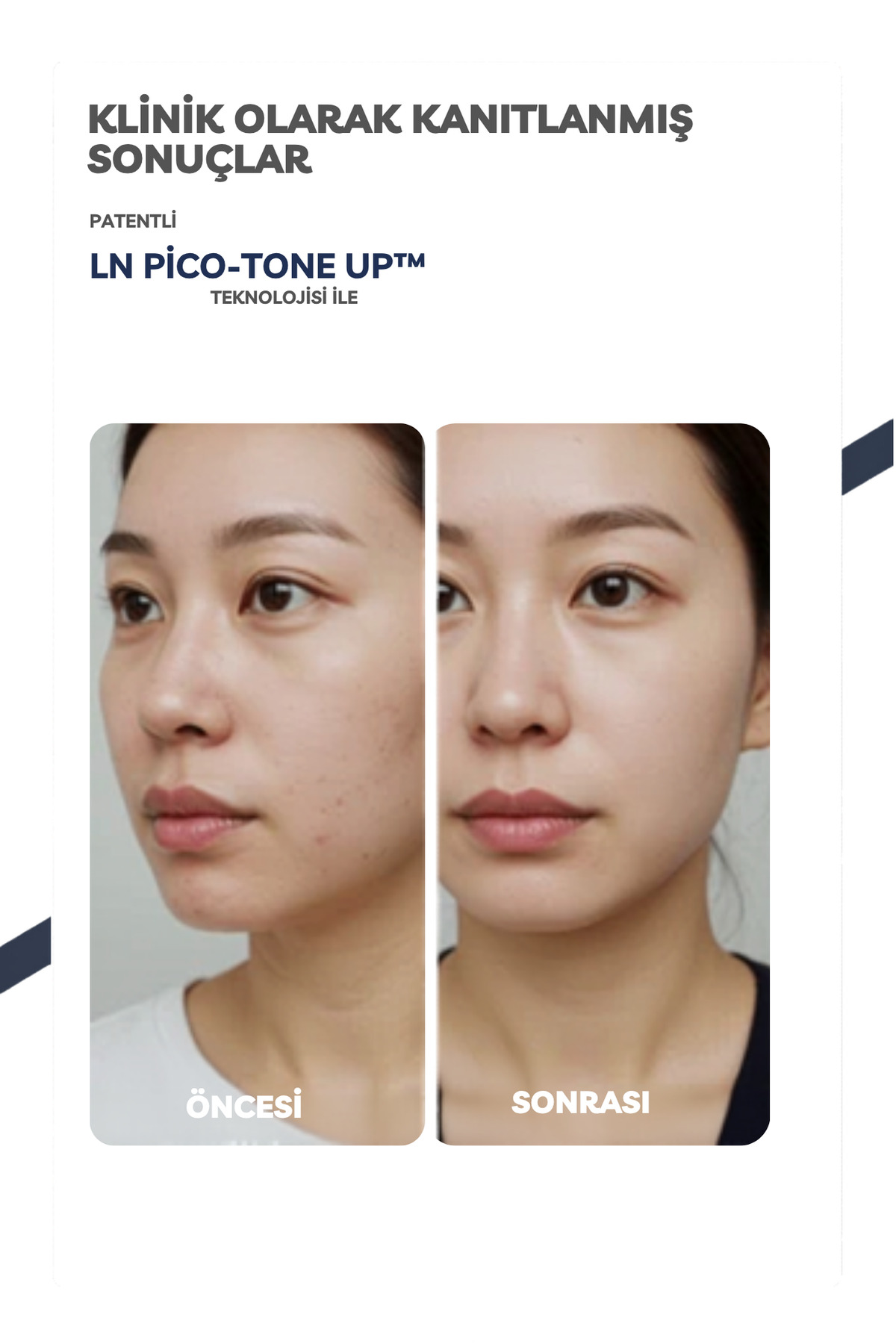 MelaZERO Dark Spot Toning Ampoule | 6'lı Aydınlatıcı Aktif ile Leke ve Hiperpigmentasyon Karşıtı Ampul, 32ml — MZTA32N — تصویر 8 از 8
