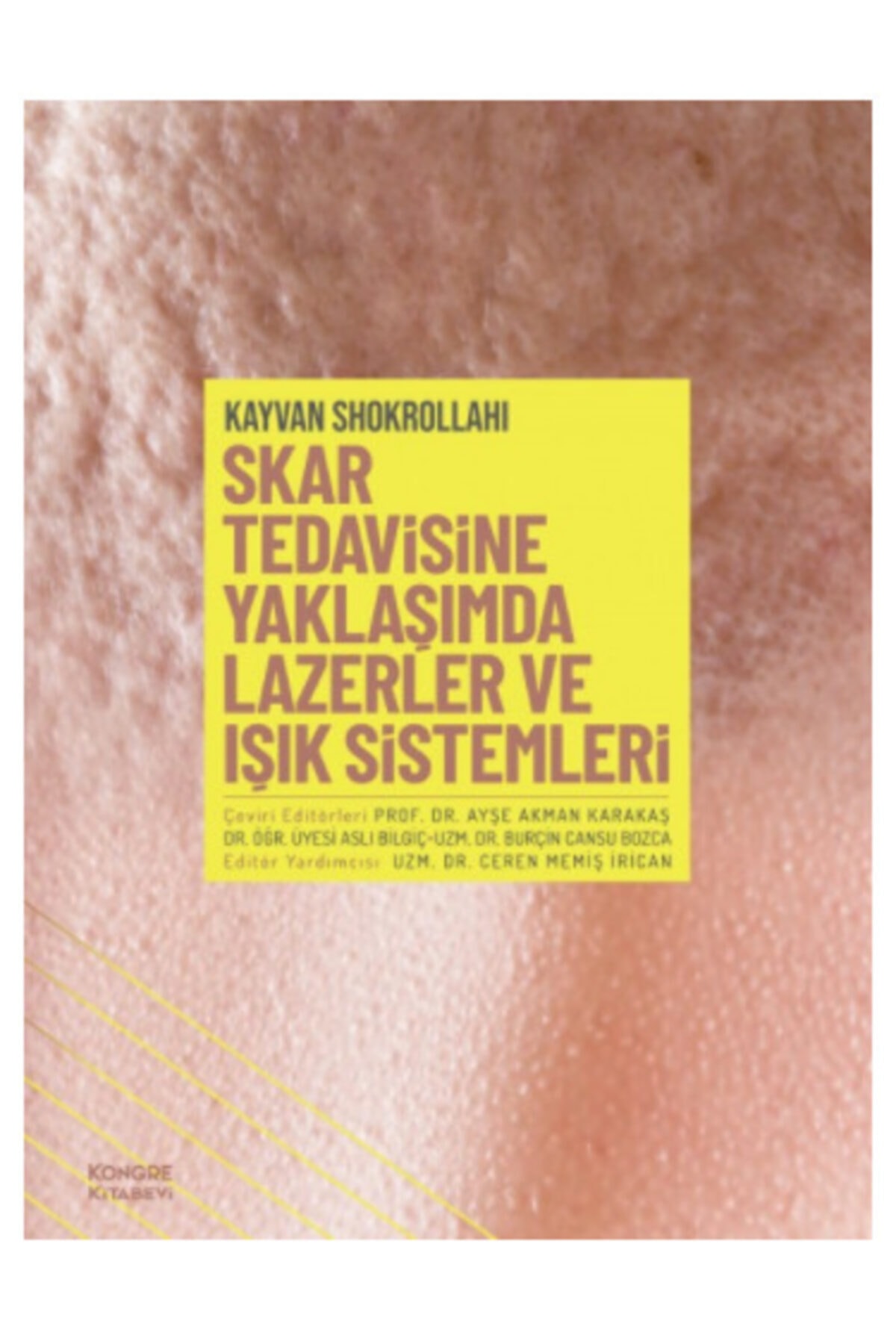 Kongre Kitabevi Skar Tedavisine Yaklaşımda Lazerler Ve Işık Sistemleri