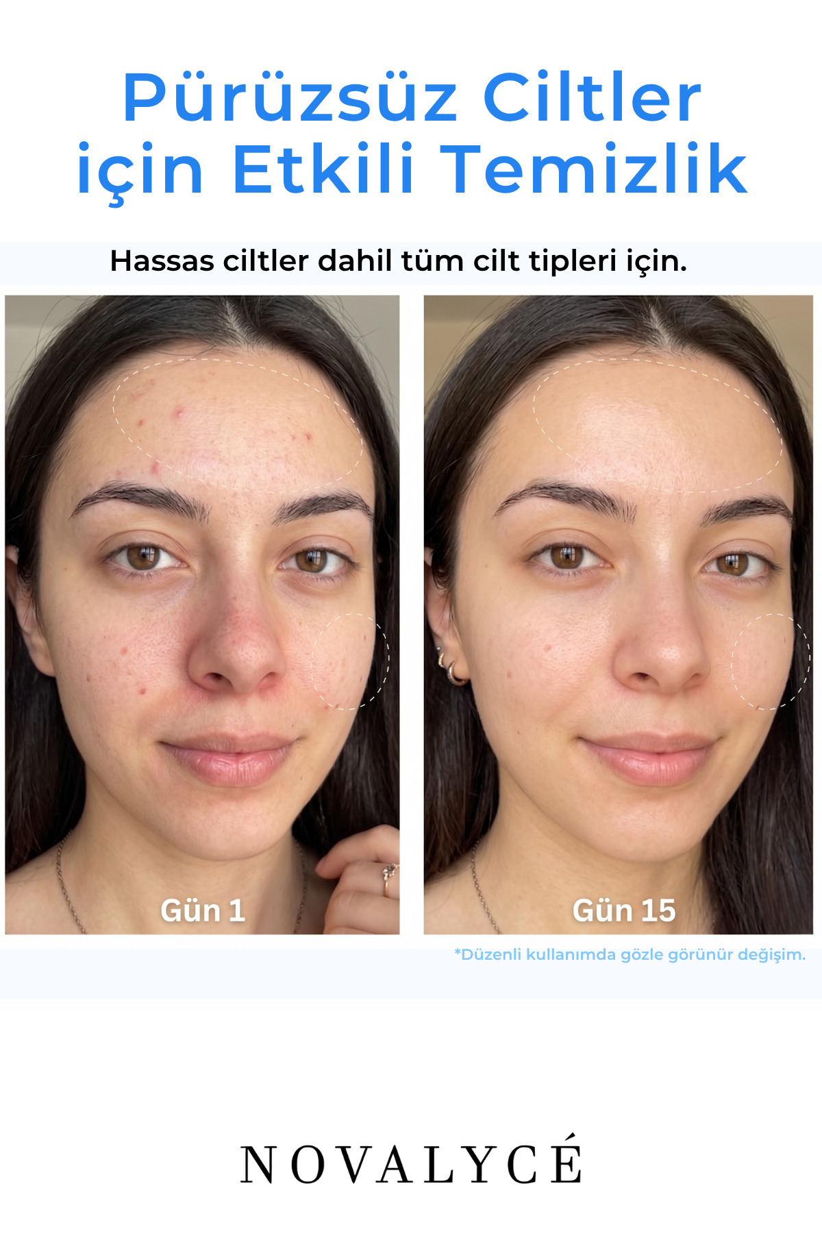 Temizleyici ve Arındırıcı Yüz Bakım Seti Temizleme Jeli + Tonik 200ml+ 200ml — ST00005 — تصویر 3 از 6