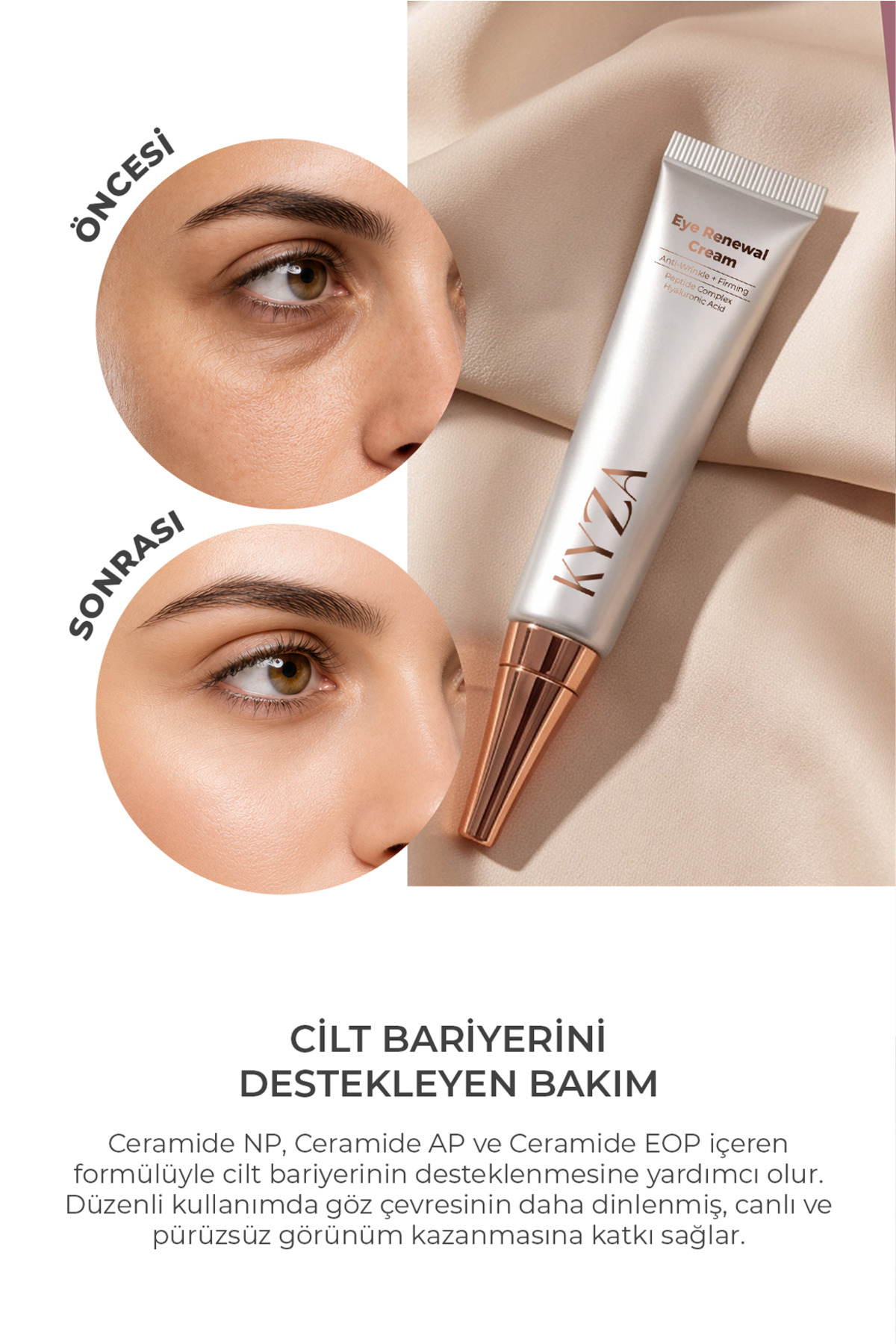 Eye Renewal Cream Işıltı Veren Göz Çevresi Kremi 15 ml — KYZ-GZ — تصویر 3 از 6