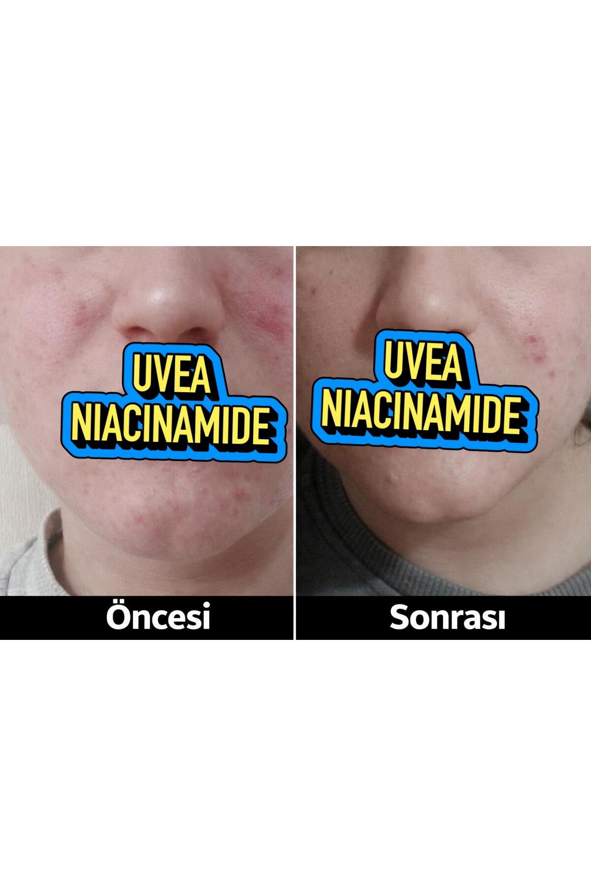 %10 Niacinamide Cilt Bakım Serumu 30 ml – Leke Karşıtı, Gözenek Sıkılaştırıcı ve Ton Eşitleyici — CİLT BAKIM SERUMU — تصویر 8 از 8