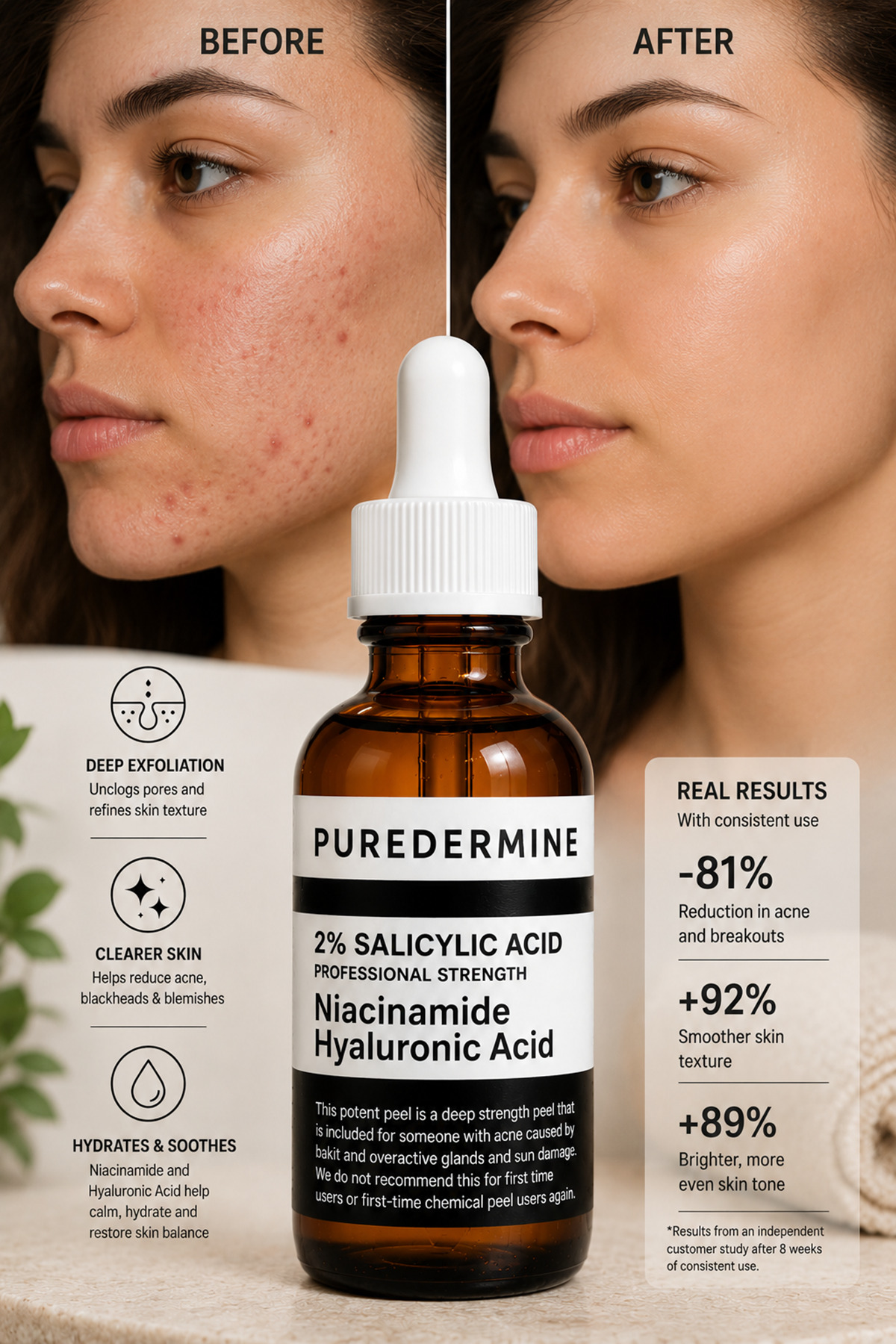 Salisilik Asit Serum %2 BHA İçerikli Niacinamide ve Hyaluronik Asit Destekli Siyah Nokta Karşıtı Yağlı ve Akneye Eğilimli Ciltler İçin Bakım Serumu — 35-2 — تصویر 8 از 8
