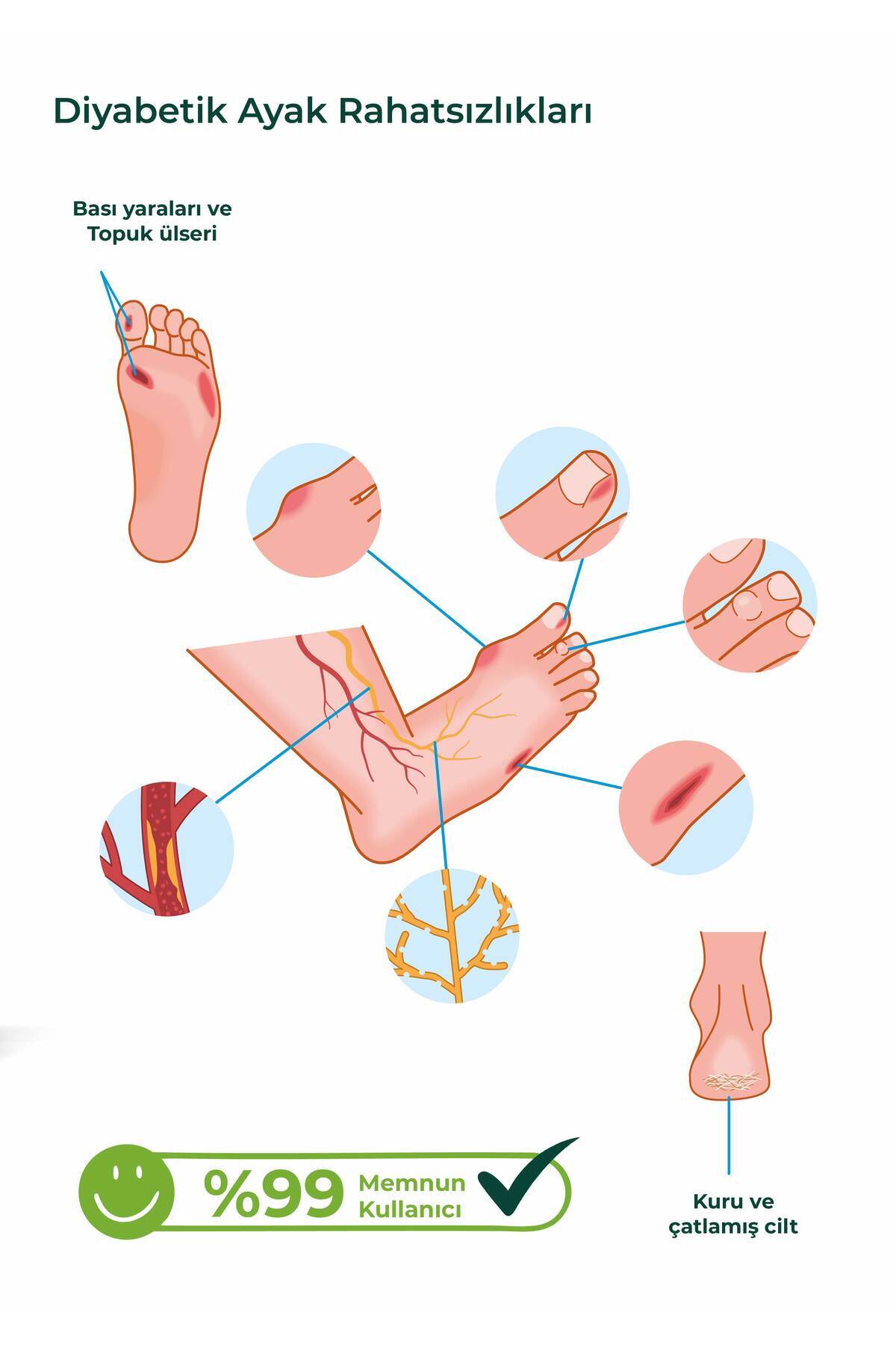 کرم مراقبت از پا x 3 - مخصوص پوست حساس (10٪ اوره، کره شیا، موم زنبور عسل) — medcoverayakbakımx3 — تصویر 3 از 6