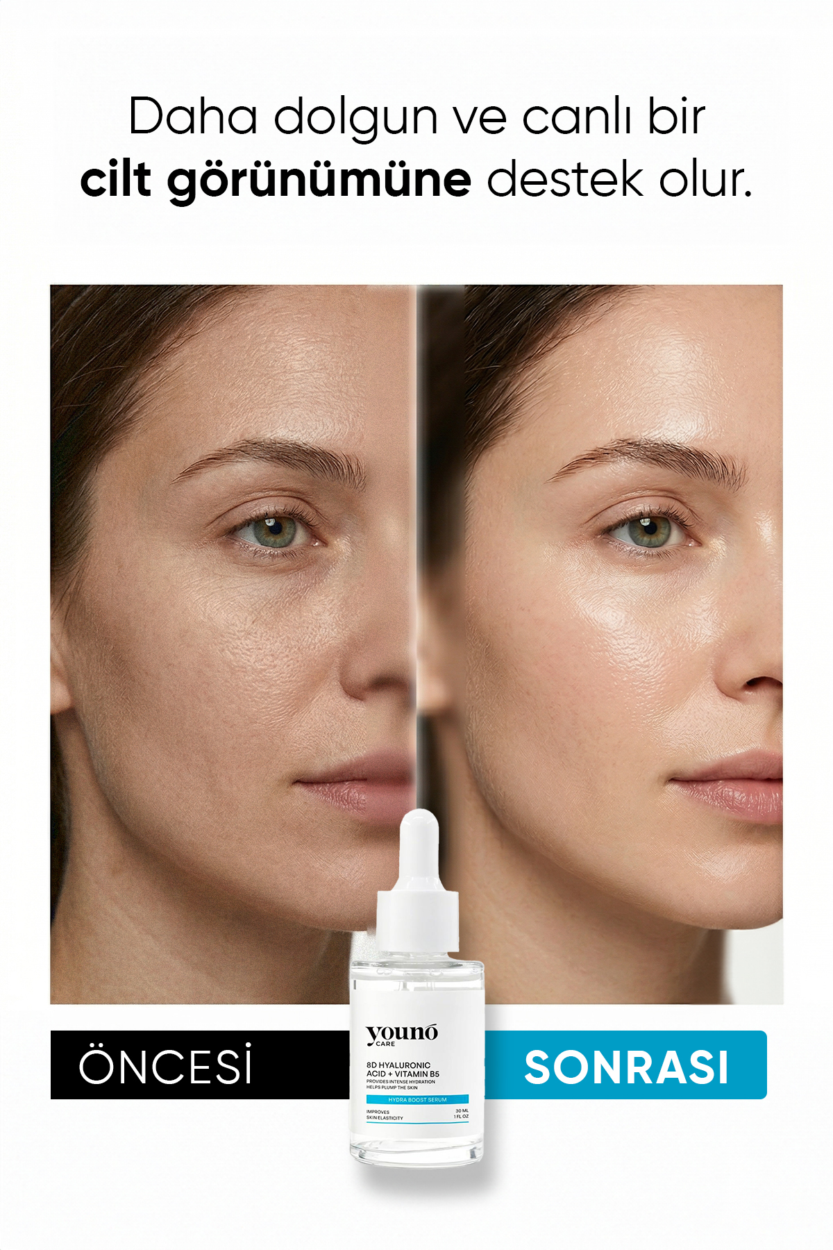 8D Hyaluronik Asit Serum 30 ml| Yoğun Nemlendirici Serum 18 Amino Asit, Beta-Glucan, Panthenol, Urea — YC-SKN-HBS-30 — تصویر 6 از 8