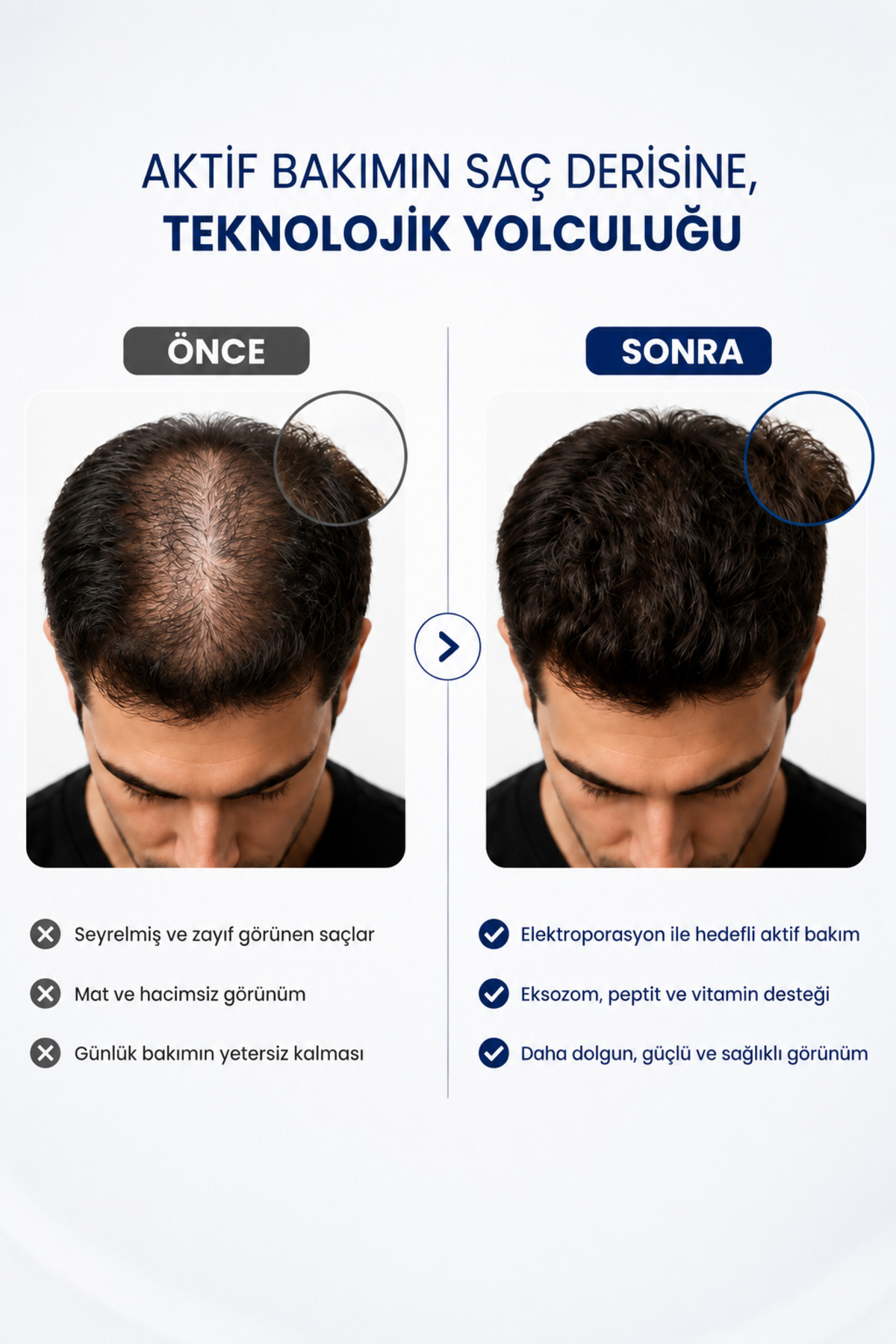 Exosome Saç Serumu 25 ml – Saç Kökü ve Saç Derisi Bakım Serumu — OPES2026 — تصویر 4 از 8