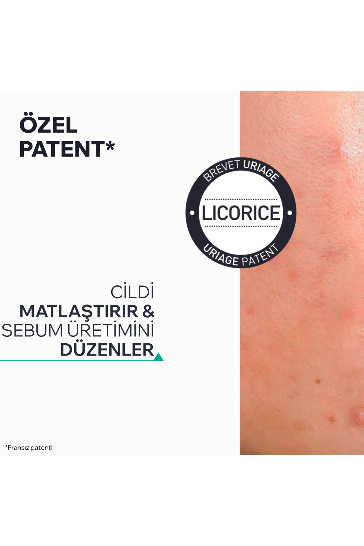HYSEAC 3Regul+ Karma ve Yağlı Ciltler için Leke ve Siyah Nokta Oluşumunu Önleyen SPF50+ Güneş Kremi — 3661434027901 — تصویر 5 از 8