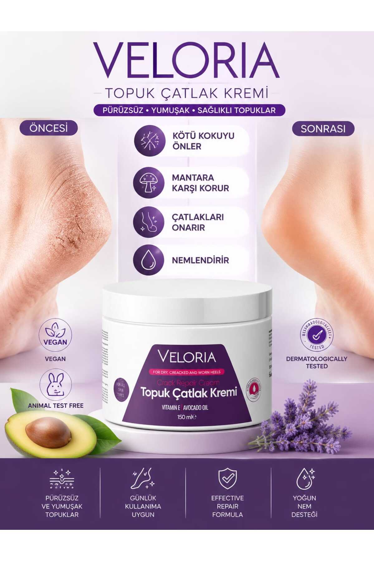 Veloria Cosmetics Ayak ve Topuk Çatlak, Koku, Kaşındama ve Mantar