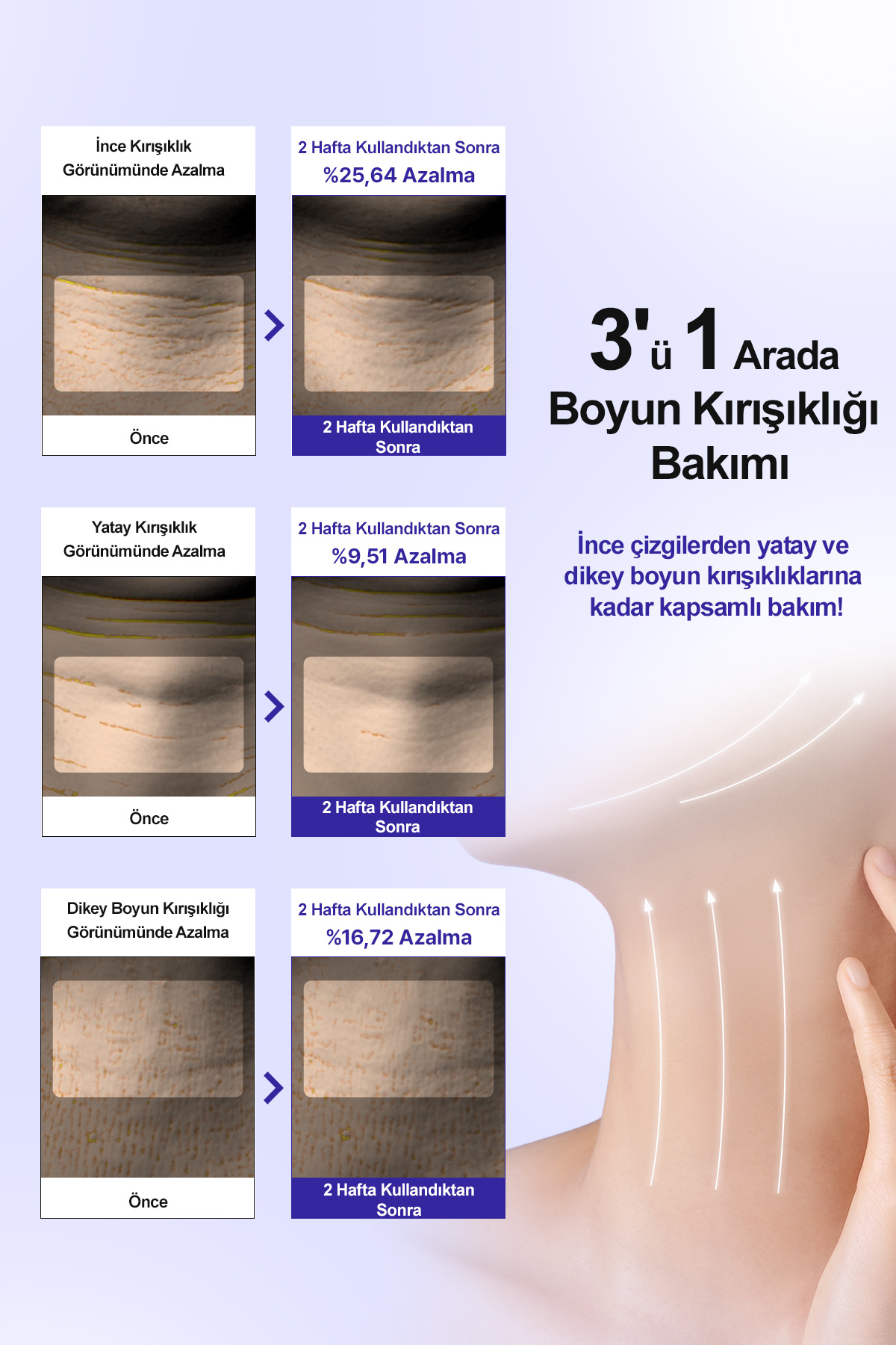 PDRN ve Kolajen İçerikli Kırışıklık Karşıtı, Aydınlatıcı Boyun Kremi DERMA:B Balance FIT Neck Cream — 9827 — تصویر 4 از 9
