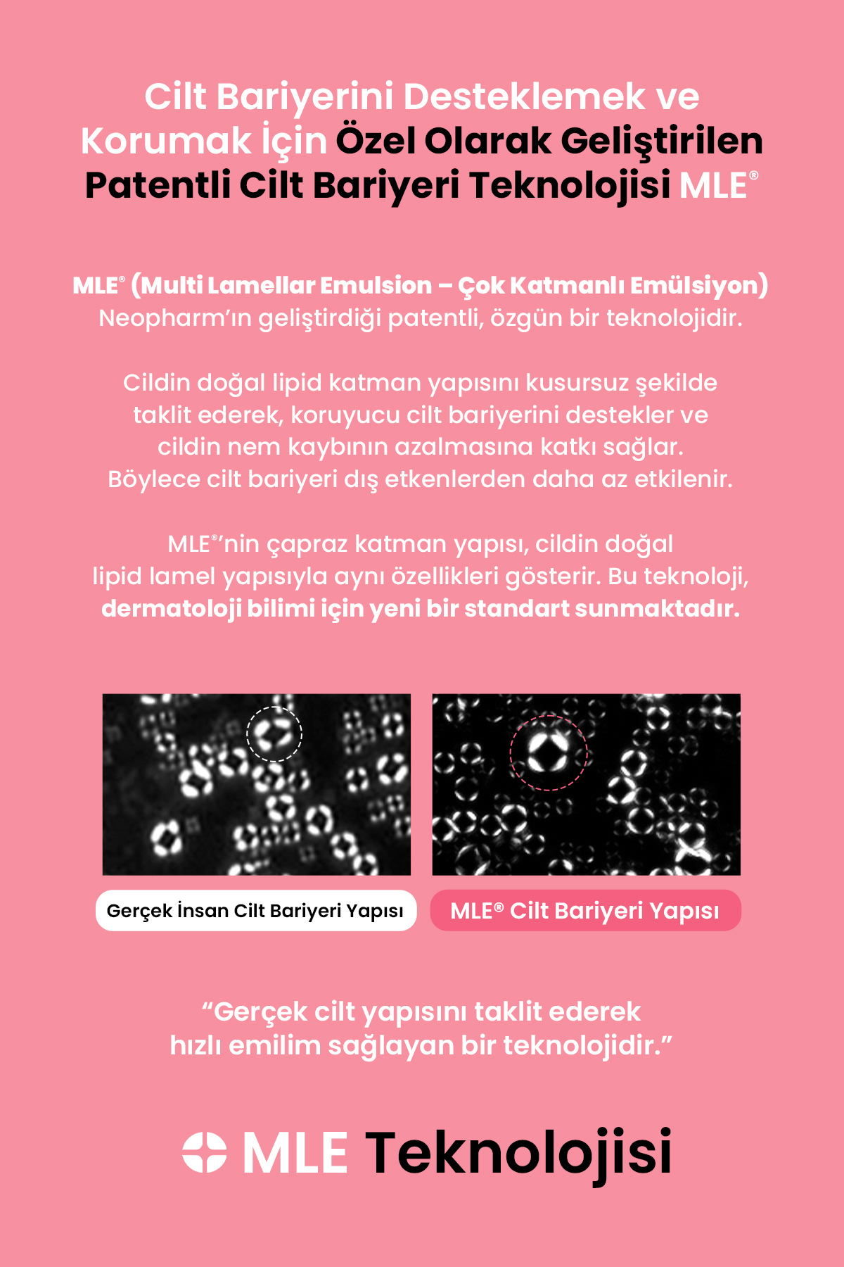 کرم ترک‌های پوستی مخصوص دوران بارداری - ۹۷۲۹ (کرم مرطوب‌کننده و مغذی قوی برای ترک‌های پوستی مخصوص زنان باردار) — تصویر 5 از 9