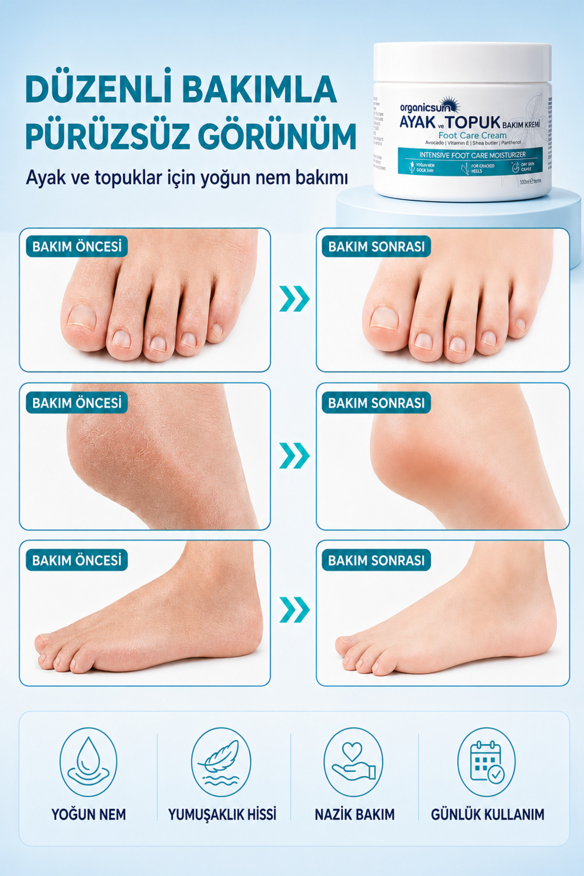 Ayak ve Topuk Çatlak Bakım Kremi 100ml - Ayak Kokusu, Tırnak Bakımı Avokado ve Shea Yağlı — 4500 — تصویر 6 از 8