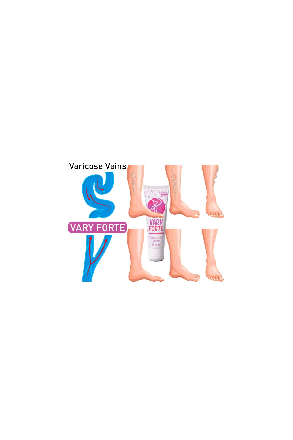 Vary Forte Tüp Krem 100 ml Yoğun Varislerinize Güçlü Tesirli — DCCBBB-Z773369-AGC01 — تصویر 3 از 3