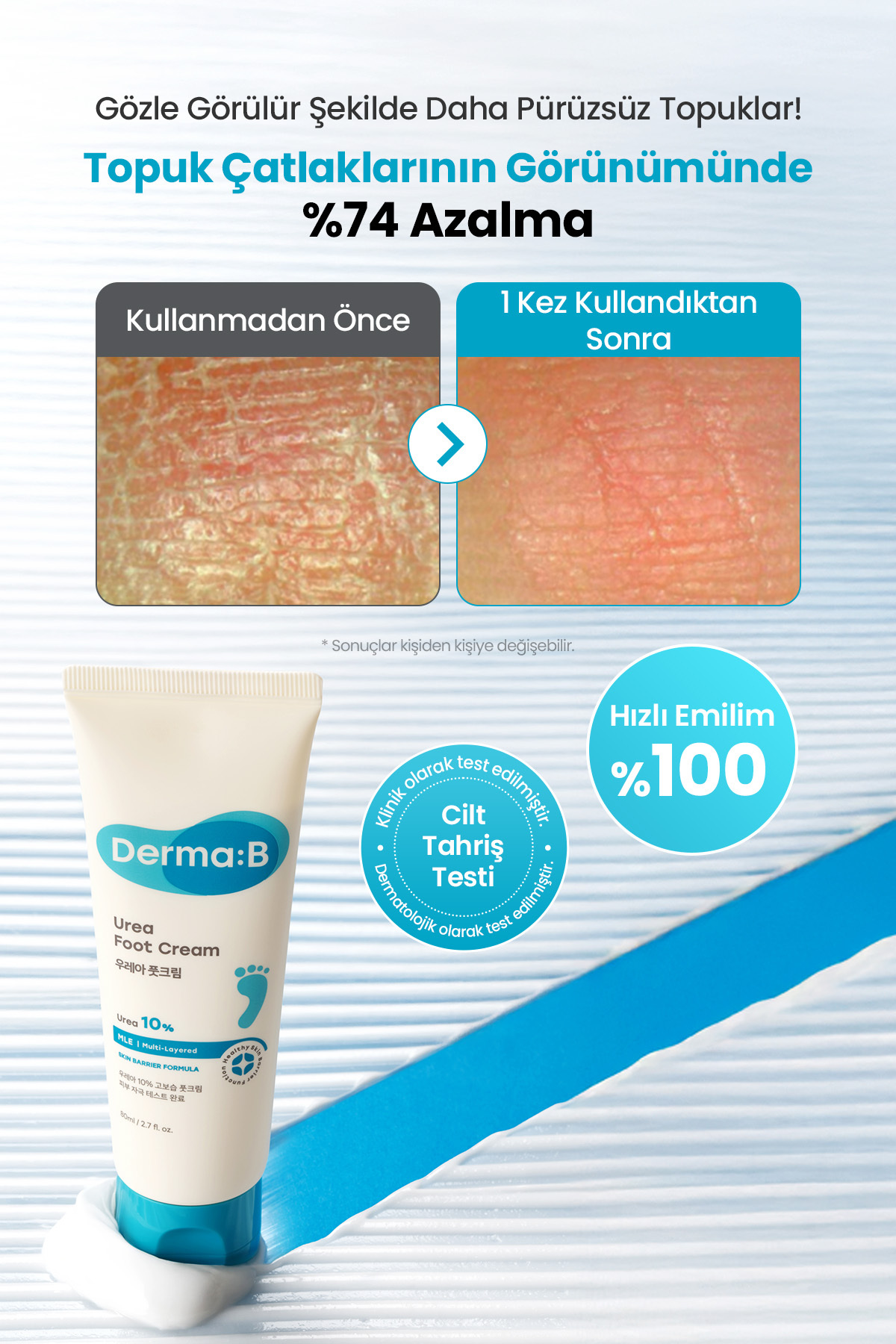 Kuru ve Çatlamış Topuklar İçin, Peeling Etkili Nemlendirici Ayak Kremi DERMA:B Urea Foot Cream — 9811 — تصویر 3 از 9