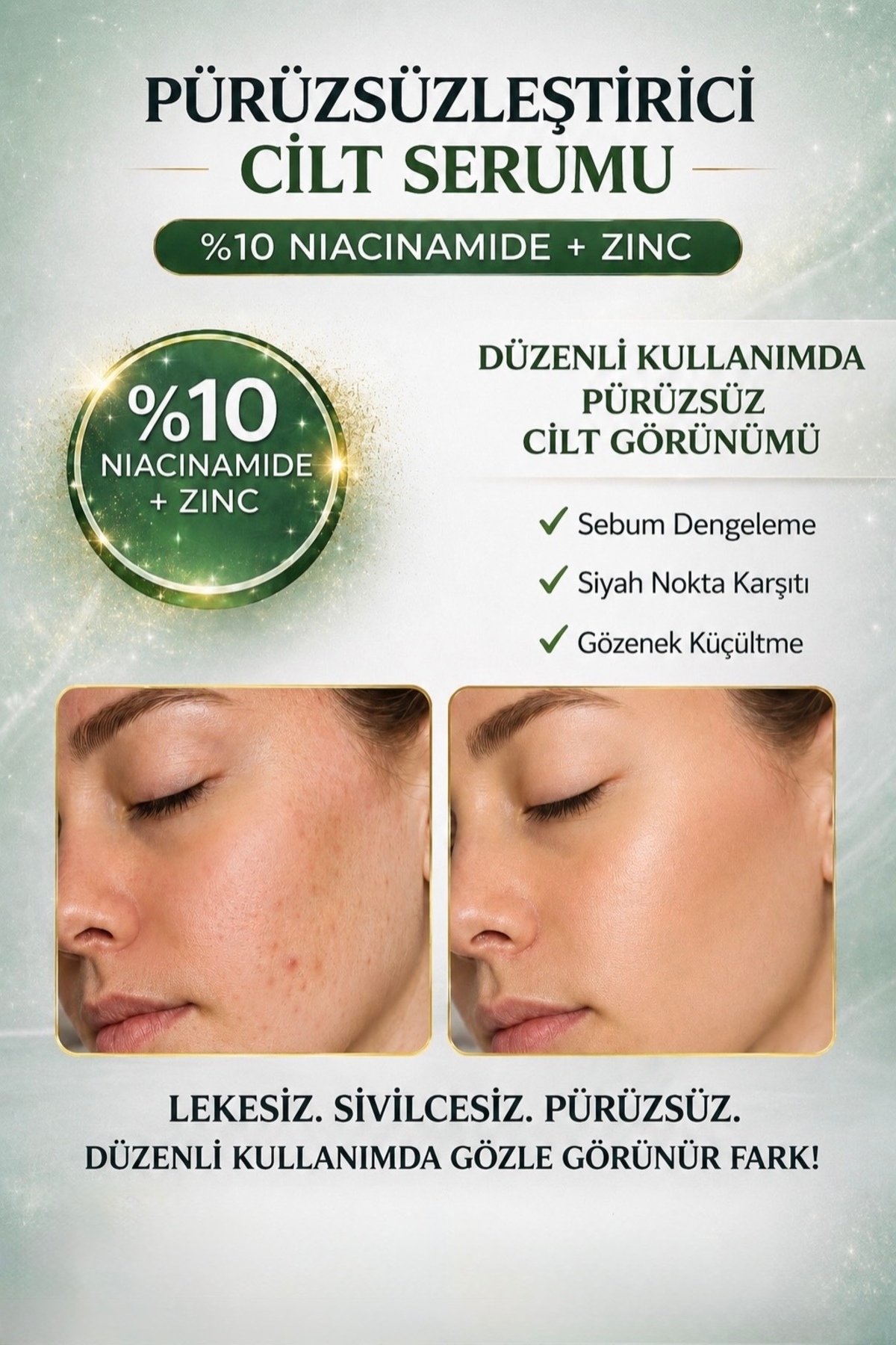 Niacinamide %10 Serum , Leke Karşıtı, Gözenek Sıkılaştırıcı Sebum Dengeleyici 30ml — TYCDOSQCFN169824563647703 — تصویر 2 از 6