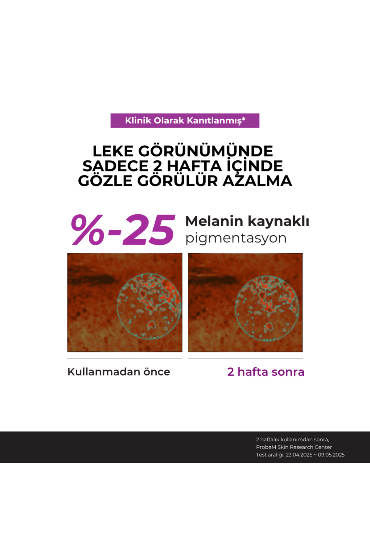 سرم نیاسینامید ۲۰٪، ۴۰ میلی‌لیتر – سرم ضد لک و روشن‌کننده — KD8809655952236 — تصویر 8 از 9