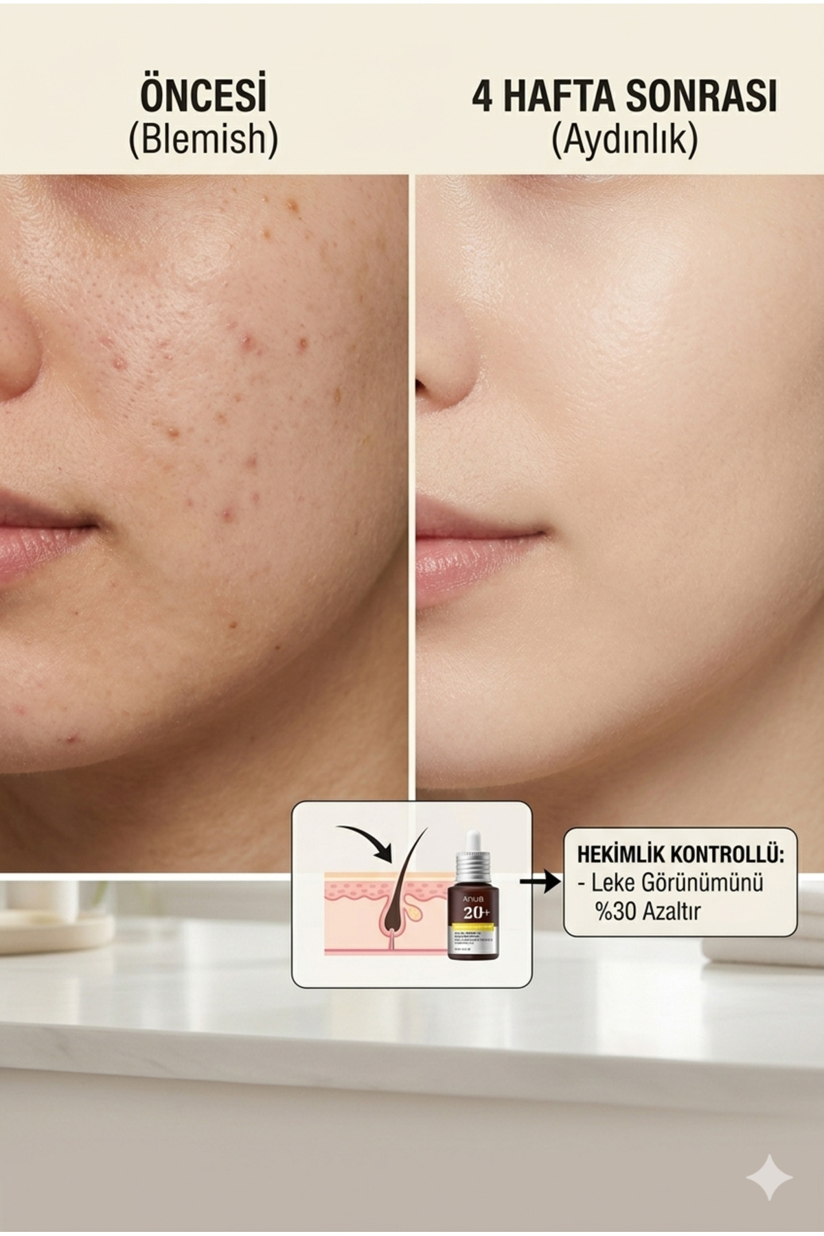 Yüzde 20 Saf C Vitamini ve E Vitamini İçeren Leke Karşıtı Aydınlatıcı Serum — anuacce — تصویر 3 از 5