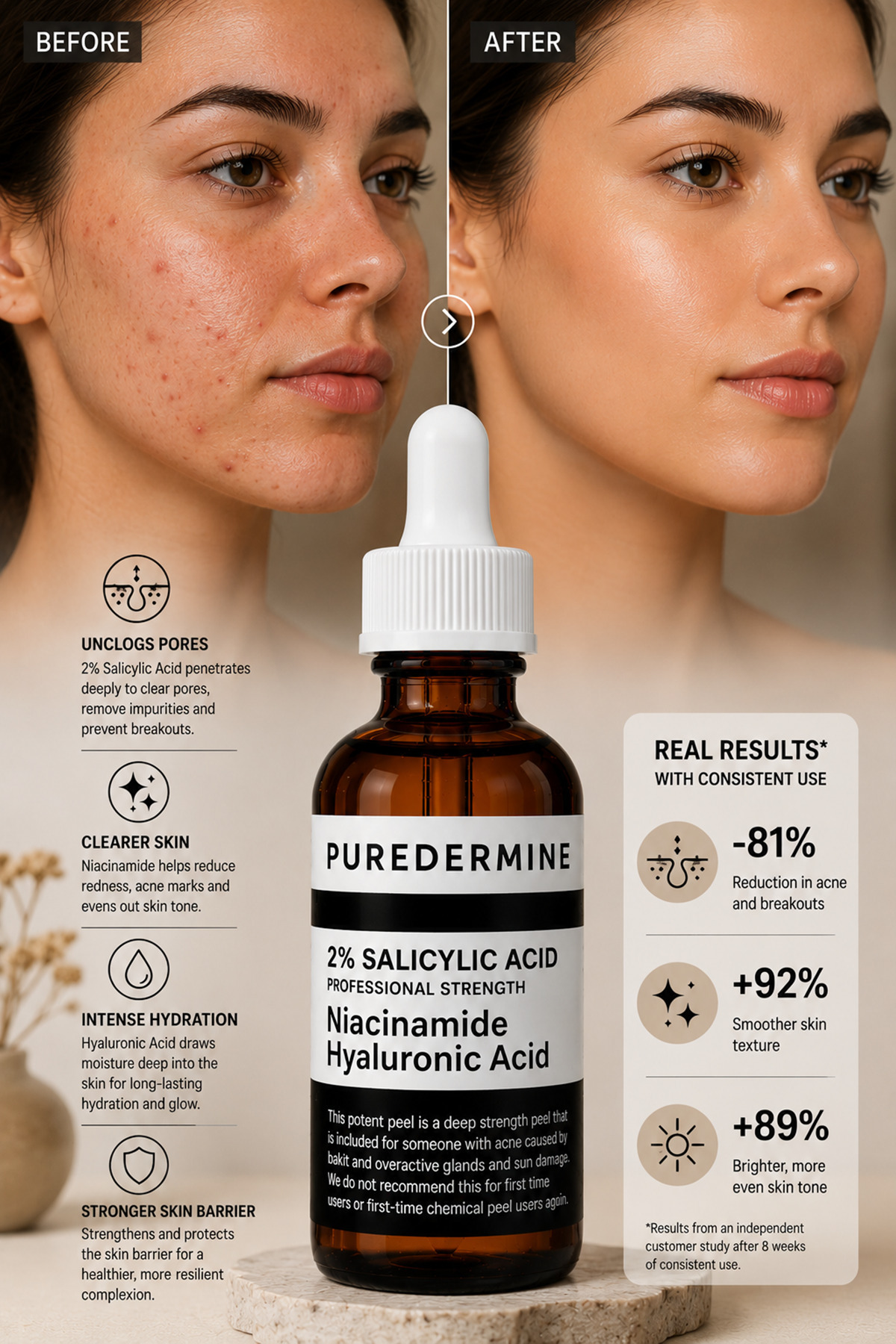 Salisilik Asit Serum %2 BHA İçerikli Niacinamide ve Hyaluronik Asit Destekli Siyah Nokta Karşıtı Yağlı ve Akneye Eğilimli Ciltler İçin Bakım Serumu — 35-2 — تصویر 6 از 8