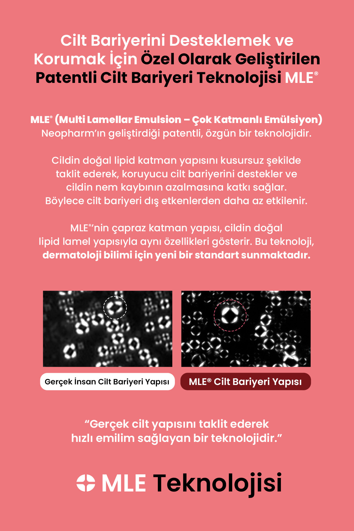 Atopik Ciltlere Özel Cilt Bariyerini Destekleyen Yoğun Nemlendirici Krem MLE Cream 65 ml — ATP01 — تصویر 5 از 9