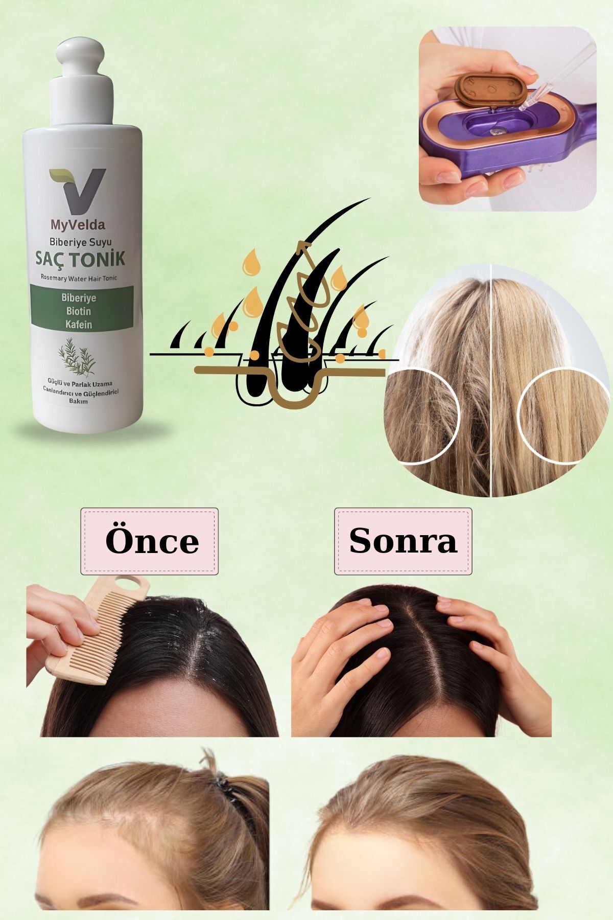 تونیک مراقبت از مو Velda Tech Haircry و myVelda، ست مراقبت از مو در منزل، ماساژ ویبره + بخار سرد + نور درمانی آبی و قرمز [رنگی] — TYC1A8D40124FE34DDC62D500 — تصویر 4 از 8