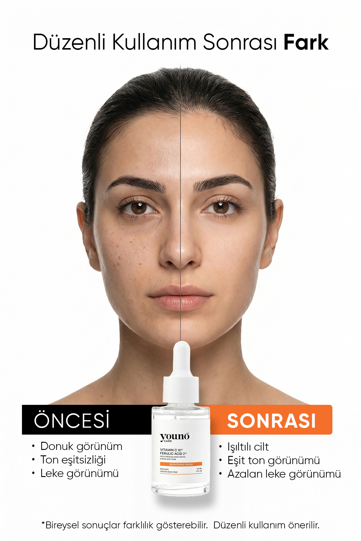 %10 C Vitamini Serum 3'lü Vitamin C Kompleksi 30 ml | Ferulic Acid | Hyaluronik Asit | Leke Karşıtı — YC-SKN-VCS-30 — تصویر 6 از 8