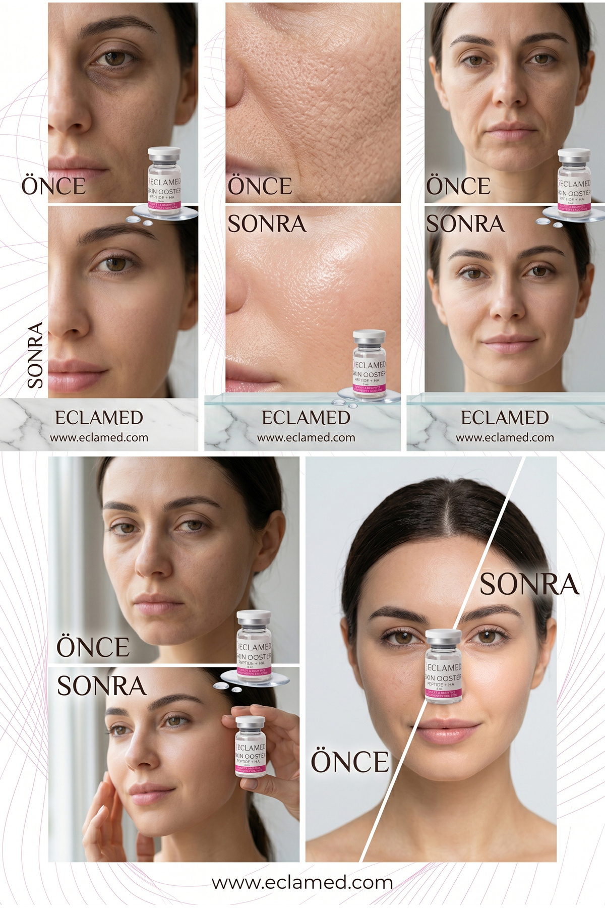 Paris Işıltısı Veren Mezoterapi 1 Flakon! 3 Ml HA Eclamed Skin Booster — NCTF3mlx1x — تصویر 3 از 6