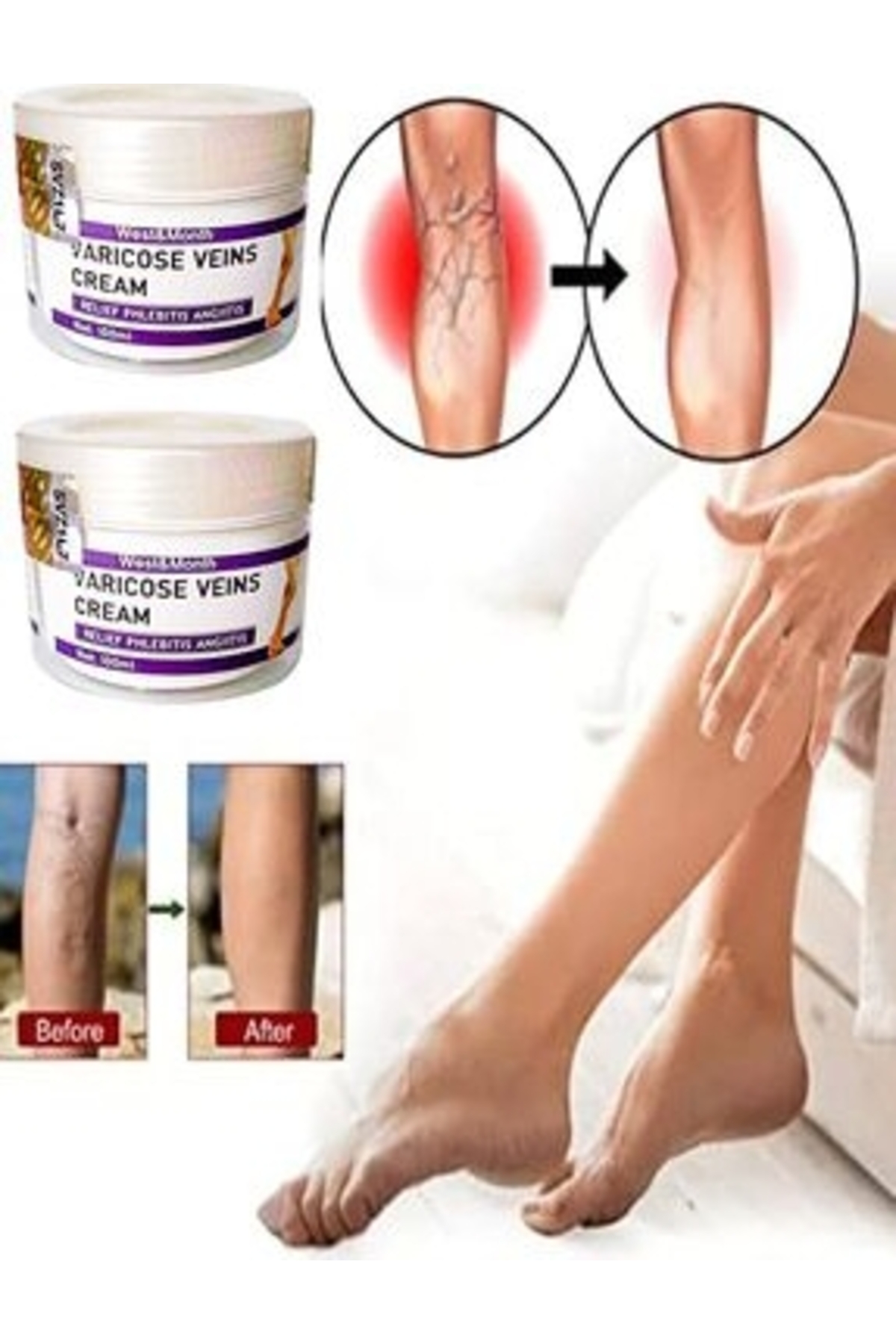 Bezos Varicose And Spider Veins Soothing Leg Cream Bacak Bakım Kremi 100 ml x 2 Adet — GU-EYF-21491-AGC01