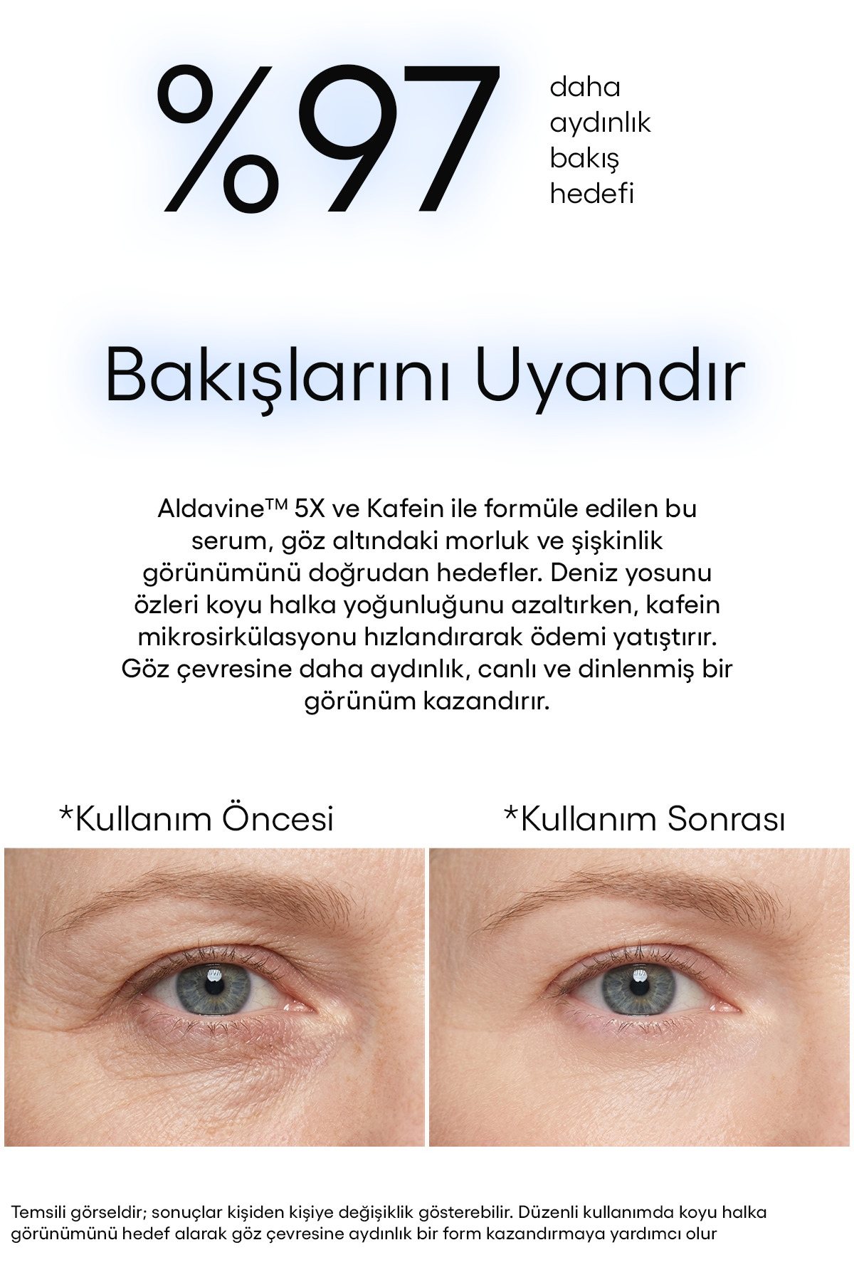 سرم دور چشم آلداوین ۵X + کافئین ۸D هیالورونیک اسید - رفع تیرگی و پف دور چشم — KRS658 — تصویر 4 از 4